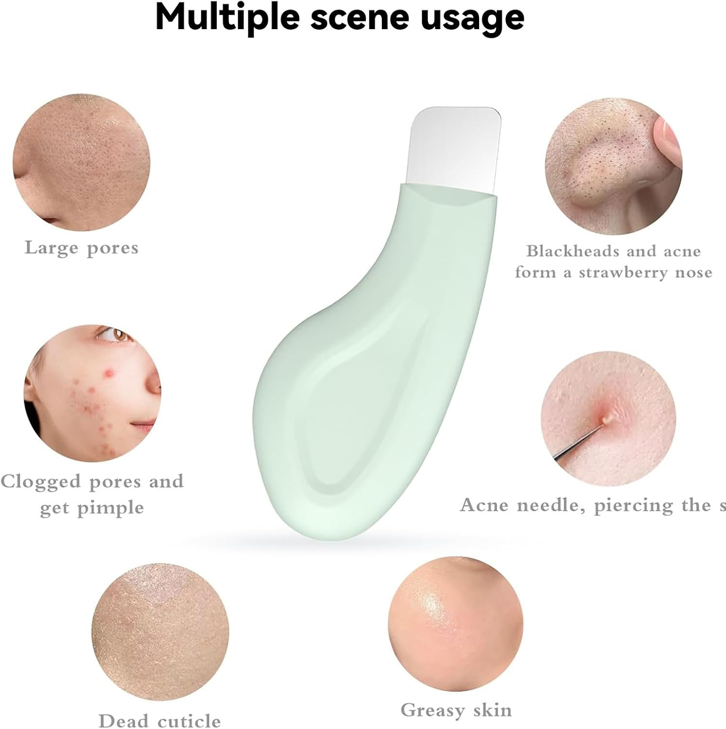 Tzylomirx Professional Blackhead Remover Tool, Skin Care Tools, Can Be Used with Mud Cream and Cleansing Oil, Safe and Mild for Men and Women image number 2