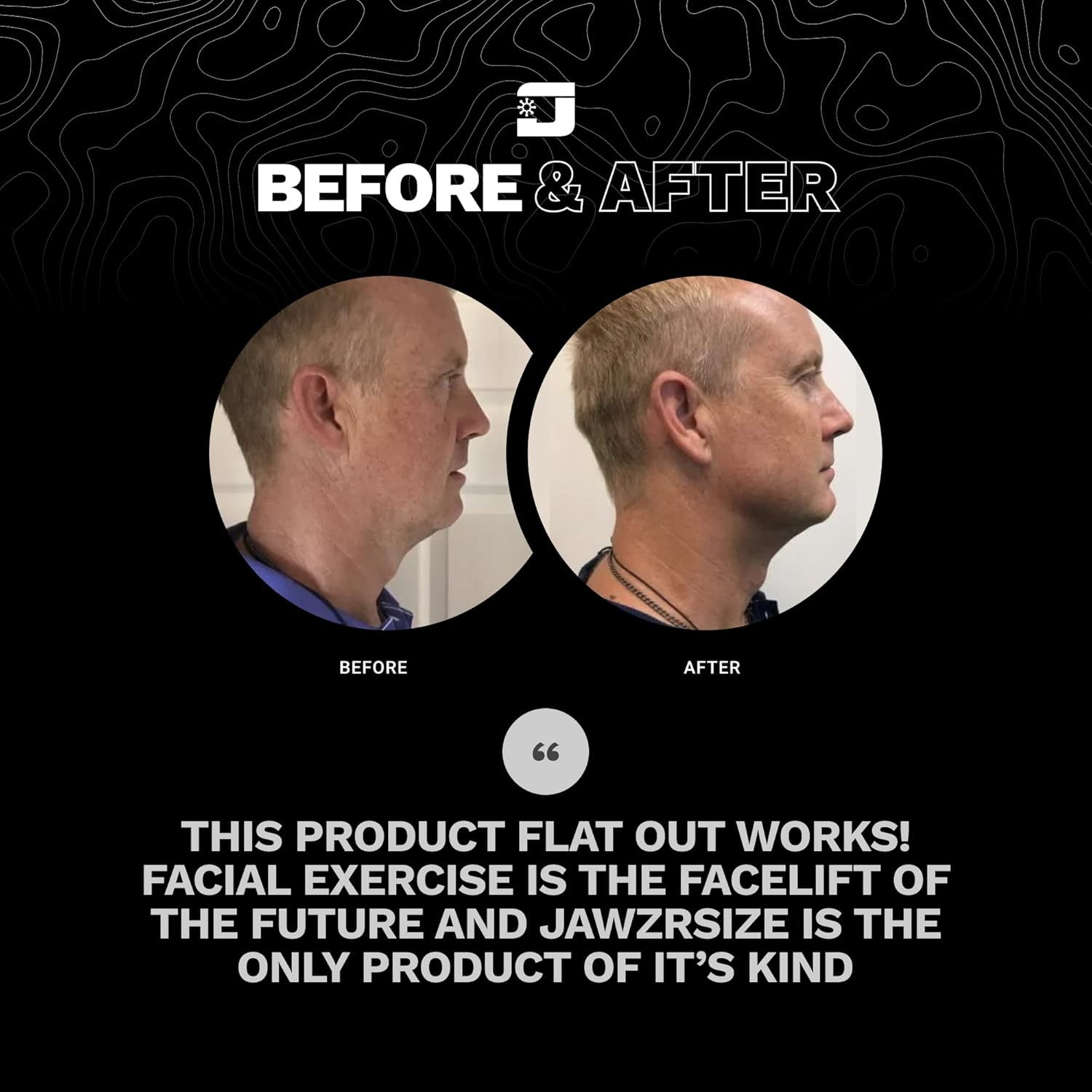 Jawzrsize Pop 'N Go Jaw, Face, and Neck Exerciser - Reduce Stress and Cravings by Exercising Your Jaws - Facial Exerciser (Advanced Green) - Blue image number 6