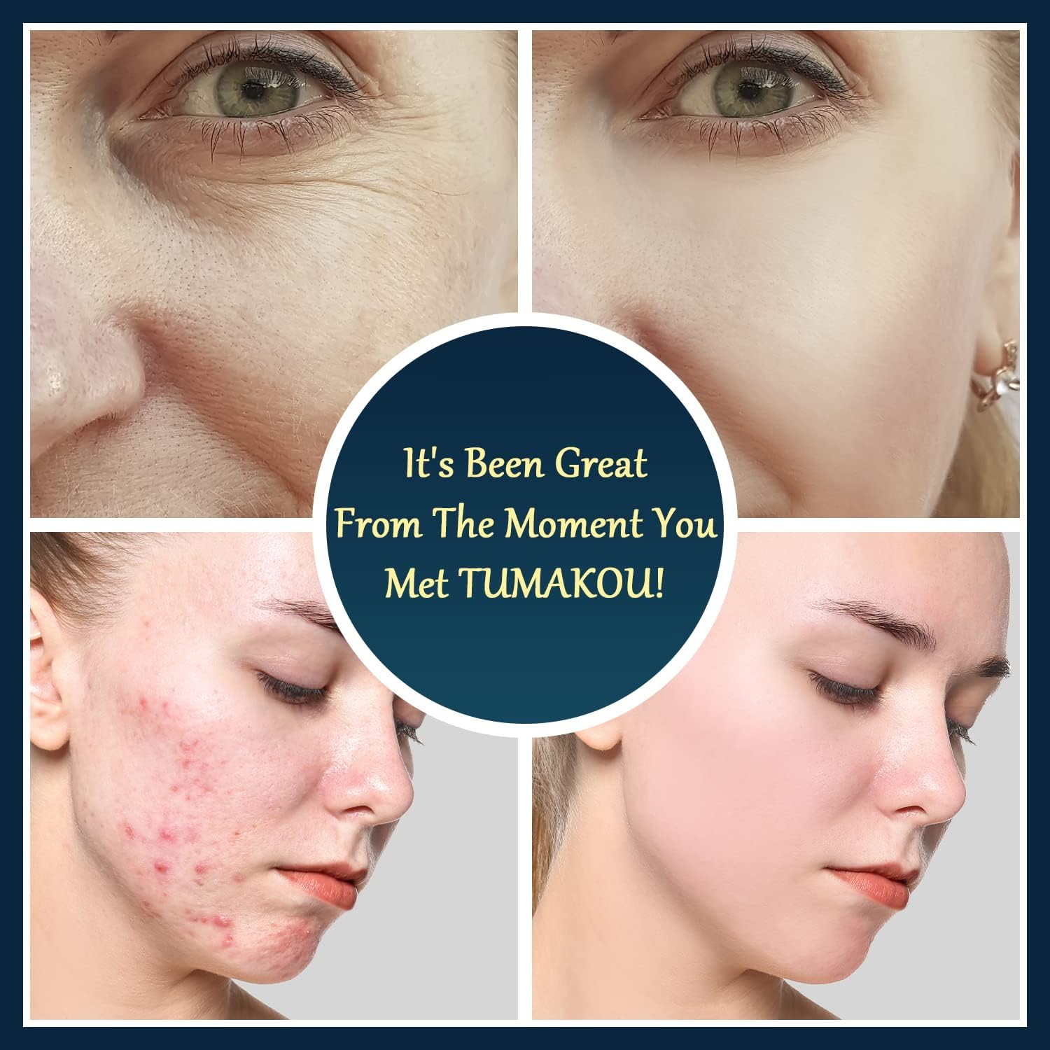 High Frequency Facial Wand - TUMAKOU Portable Handheld Blue High Frequency Facial Machine Skin Face Wand - with 6 Different Glass Tubes(Violet+Orange Tech) for Skin/Face/Eyes/Hair image number 2