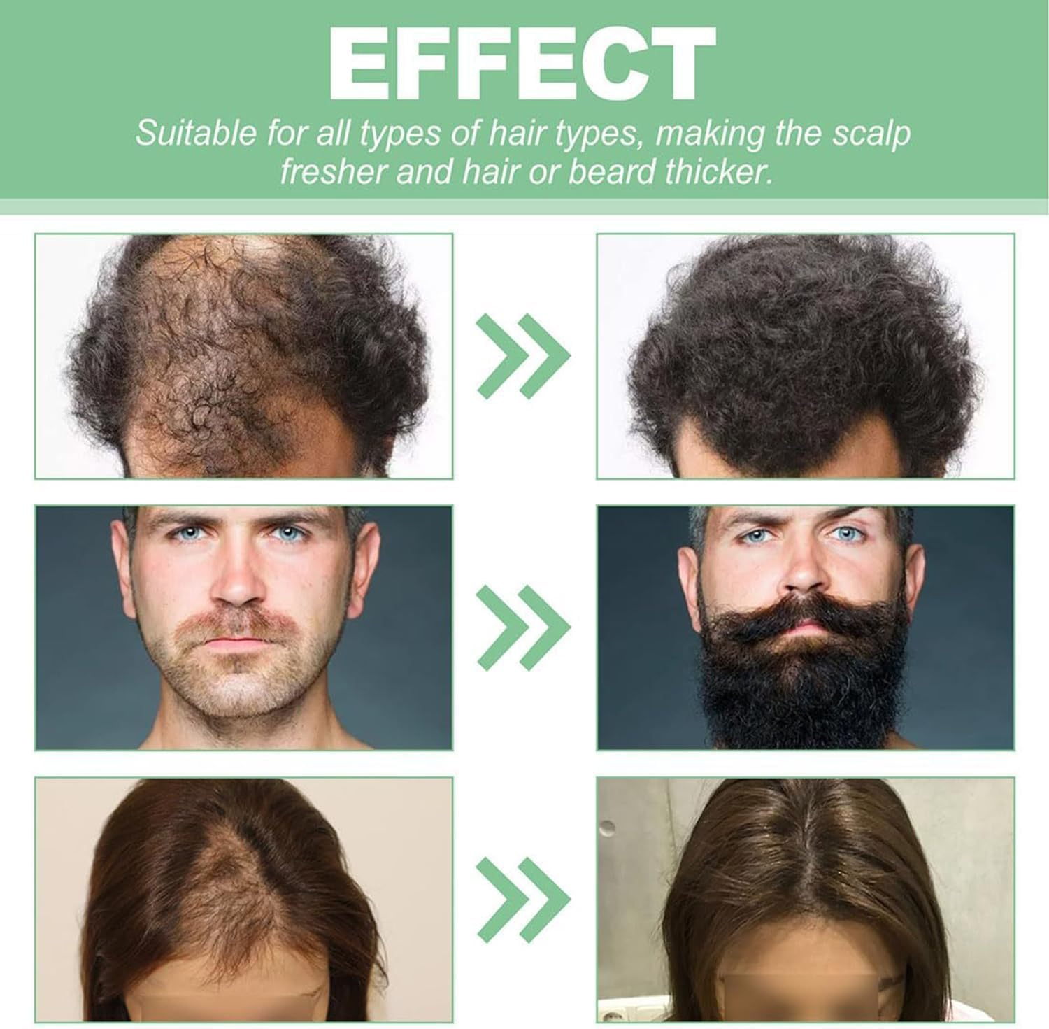 3 Pcs Renew Hair X Roll-On Hair Treatment,Renewhairx Hair and Beard Regrowth Roll on Serum,Beard Hair Regrowth Treatment Works on All Hair image number 5