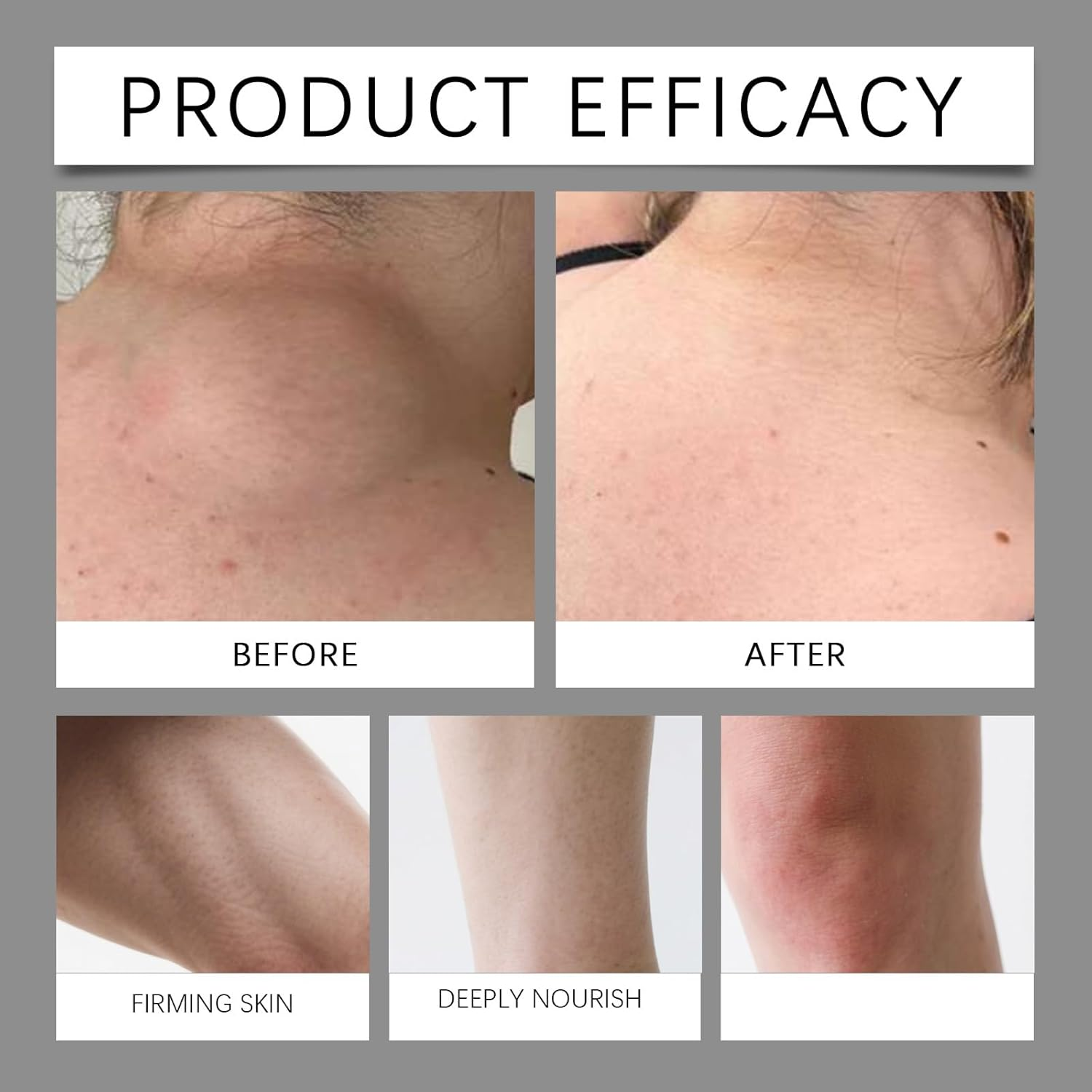 Dual-Action Renewal Cream - Black Rice & Rice Bran Moisturizer, Soothing Repair & Firming Body Cream, Advanced Hydrating Day Cream for Wrinkle & Fine Line, for All Skin Types (4)