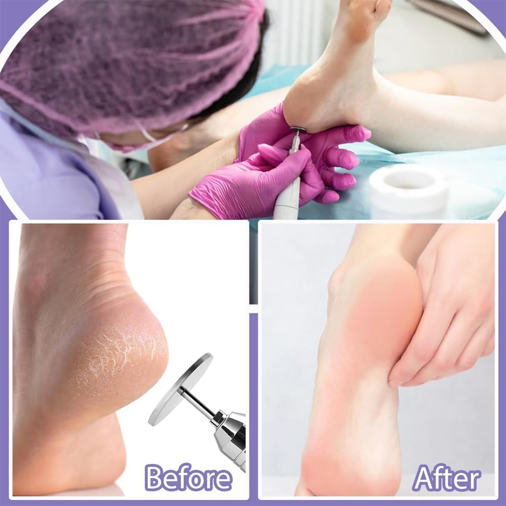 Namvo 60 PCS Colored Pedicure Sandpaper for Grinding Dead Skin and Calluses on the Soles of Feet Sand Piece Set Replacement Sand Piece with Bearing image number 6