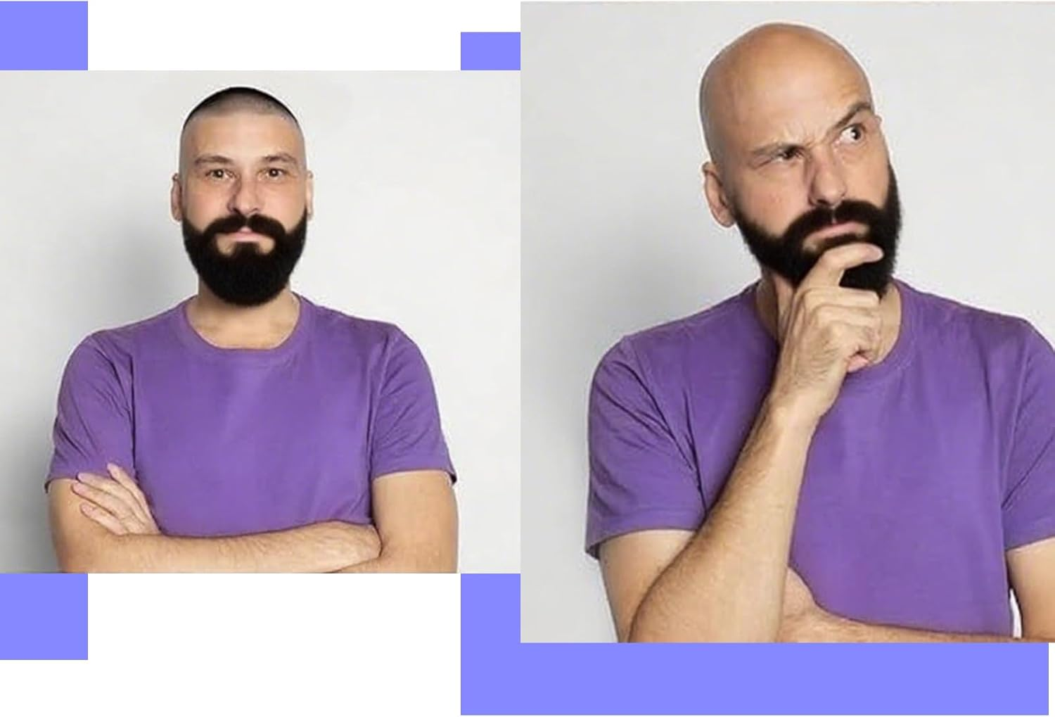 Bald Cap, Latex Bald Cap Pitbull Cosplay for Adults & Kids &ndash; Thick Elastic Fake Scalp Wig Hat for Halloween Costume Makeup, Smooth Nude Head Cover image number 4