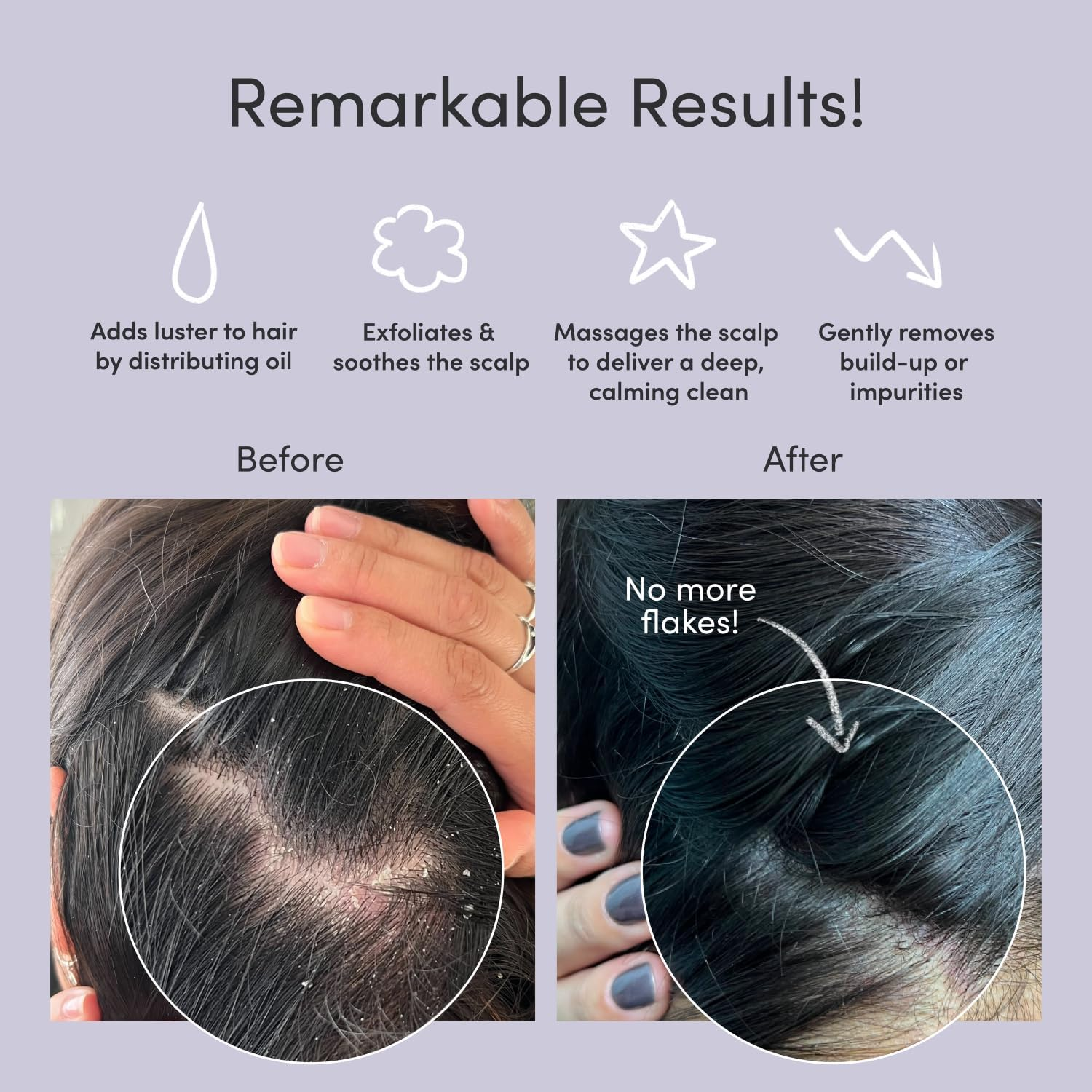 Jupiter Exfoliator Brush for Removing Dandruff & Build-Up - Detangling Scrubber for Wet or Dry Hair - Supports Circulation & Growth - for All Hair Types - Black - Black image number 5