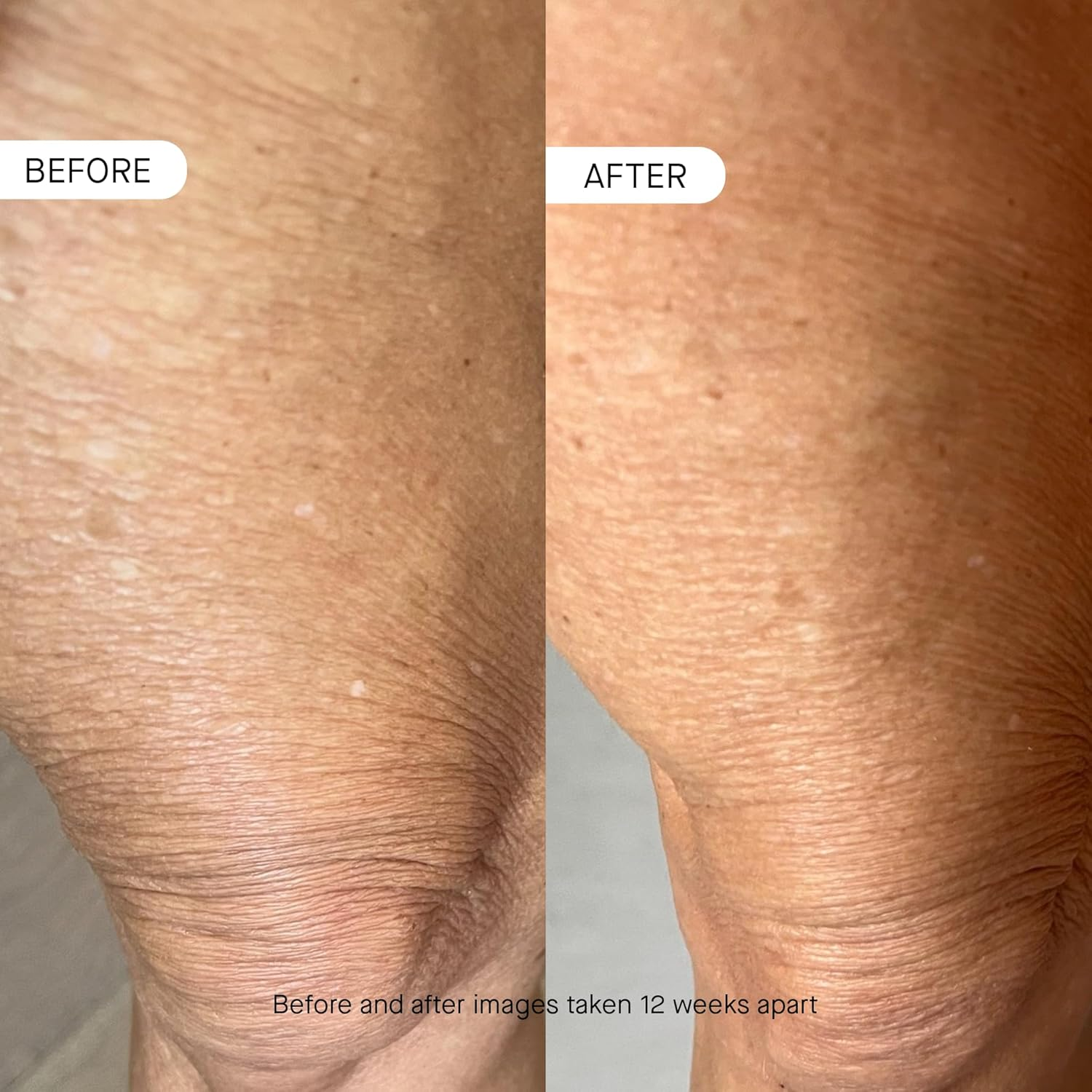 Oneskin BODY OS-01 Peptide Skin Longevity Daily Moisturizer- Improves Skin Texture & Barrier, for All Skin Types Including Sensitive Skin image number 5