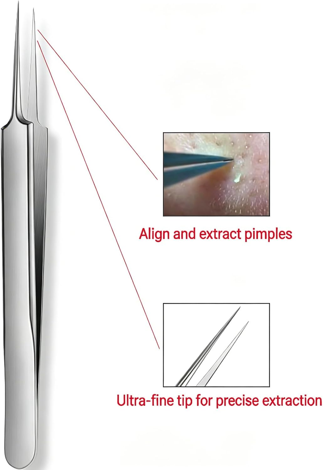 Luzcauwy Professional Facial Blackhead Remover Tweezers, Stainless Steel Acne Clip for Ingrown Hair Removal, Precision Blackhead Remover Tool and Pimple Popping Kit for Skin Care Use image number 1
