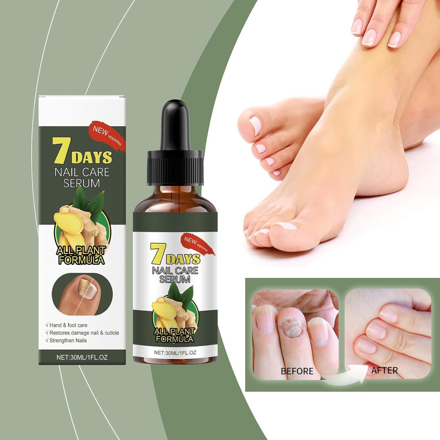 7-Day Nail Care Serum, Ginger Nail Treatment for Toenail and Fingernail for Thin, Nail Growth Serum Oil, Nail Strengthener for Damaged Nails, Restoring Healthy Nails (5PCS) - 2Pcs image number 5