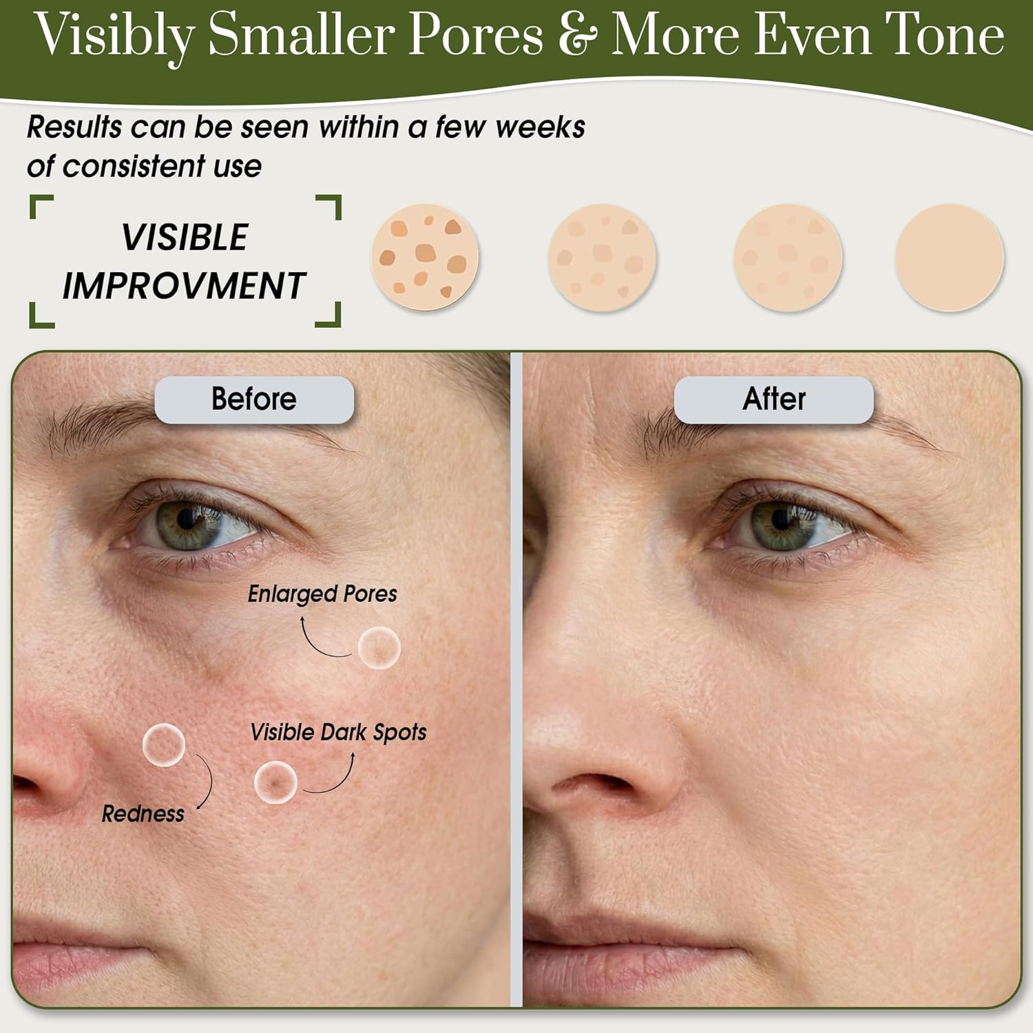 GLAMITUDE Niacinamide 10% & Zinc Serum &ndash; Pore Refining & Brightening Face Serum for Oily Skin, Uneven Tone & Dark Spots &ndash; Lightweight Daily Skincare Treatment &ndash; 30Ml