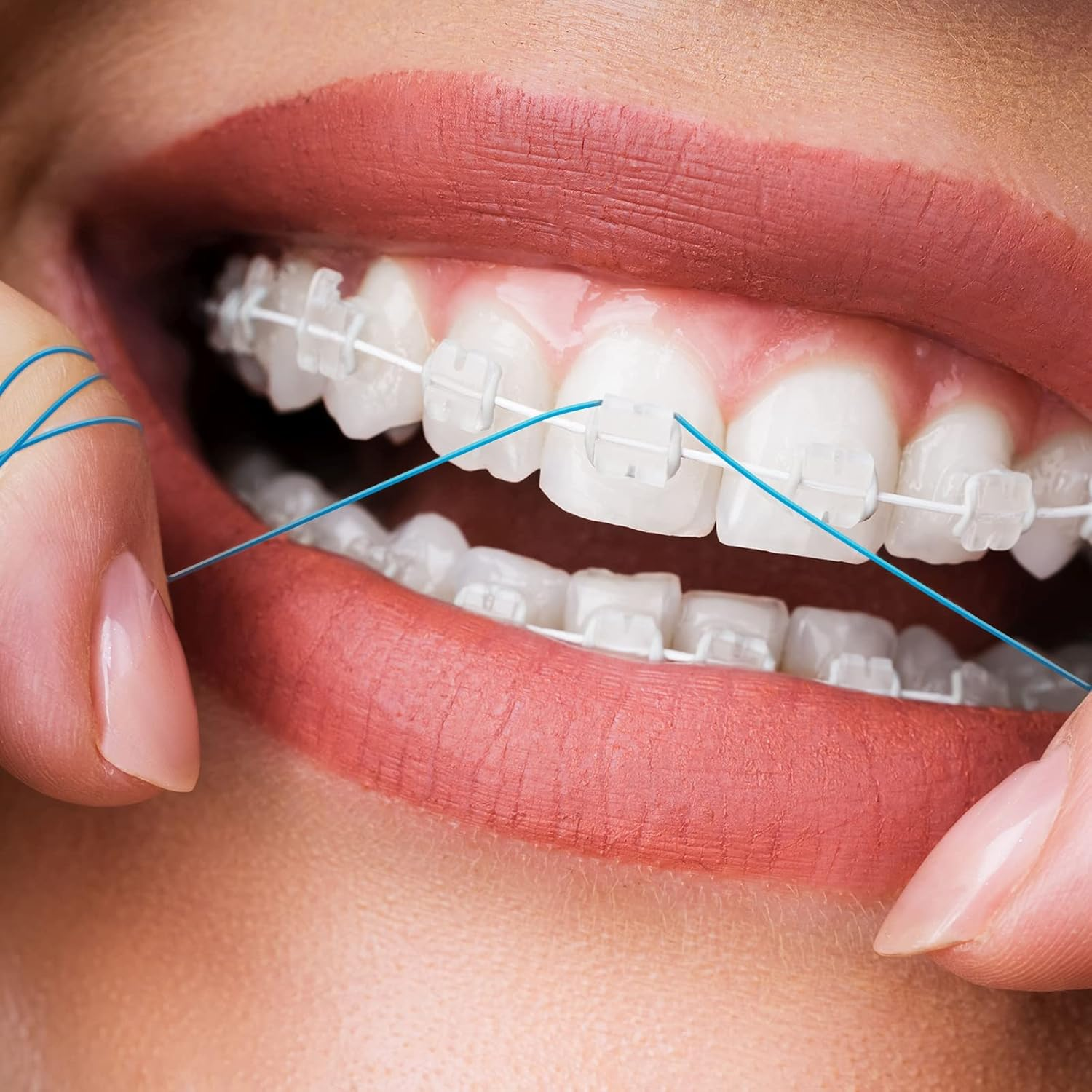 1000 Pcs Floss Threaders for Braces, Bridges, and Implants Dental Threader, Multifunctional Nylon Loop Design for Your Teeth, Pack of 20 (Blue) image number 5