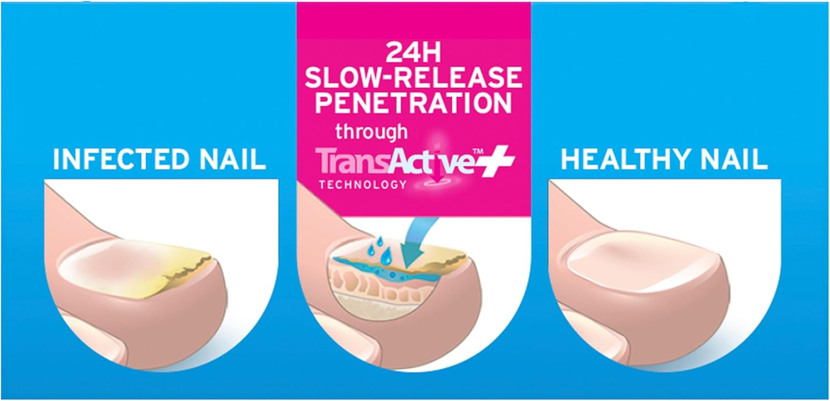 EXCILOR - Nail Fungus Treatment ULTRA - Forte - Extra Strong Formula against Persistent Nail Fungus - Clinically Proven - 1 Application per Day - 30Ml