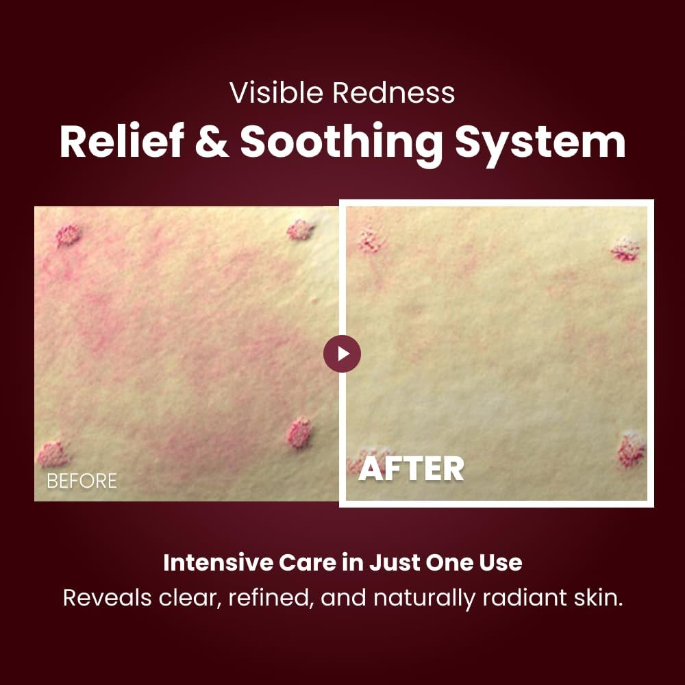 Kopher Curepair Melder SOS System image number 4