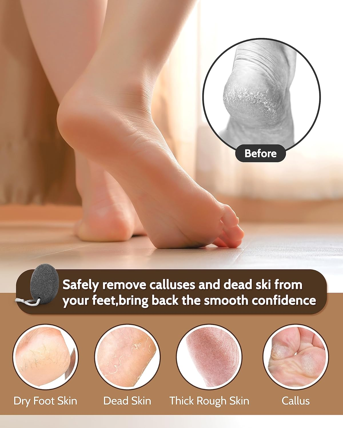 Pumice Stone Foot File, 3Pcs Set Callus Remover for Feet with Wooden Handle, Pedicure Foot Scrubber to Remove Dead Skin, Dry, Rough, Corns Skin Scraper image number 3