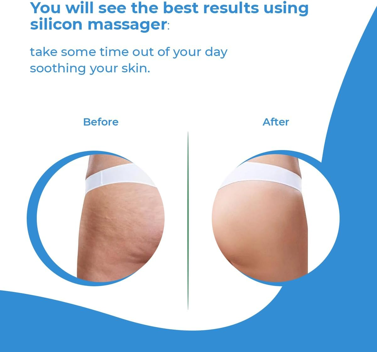 Anti Cellulite Massager Roller - Anticellulite Fascia Blaster for Cellulite Remover - Improves Blood Flow Use Cellulite Brush & Cellulite Roller with Cream or Oil for Cellulite Treatment image number 6