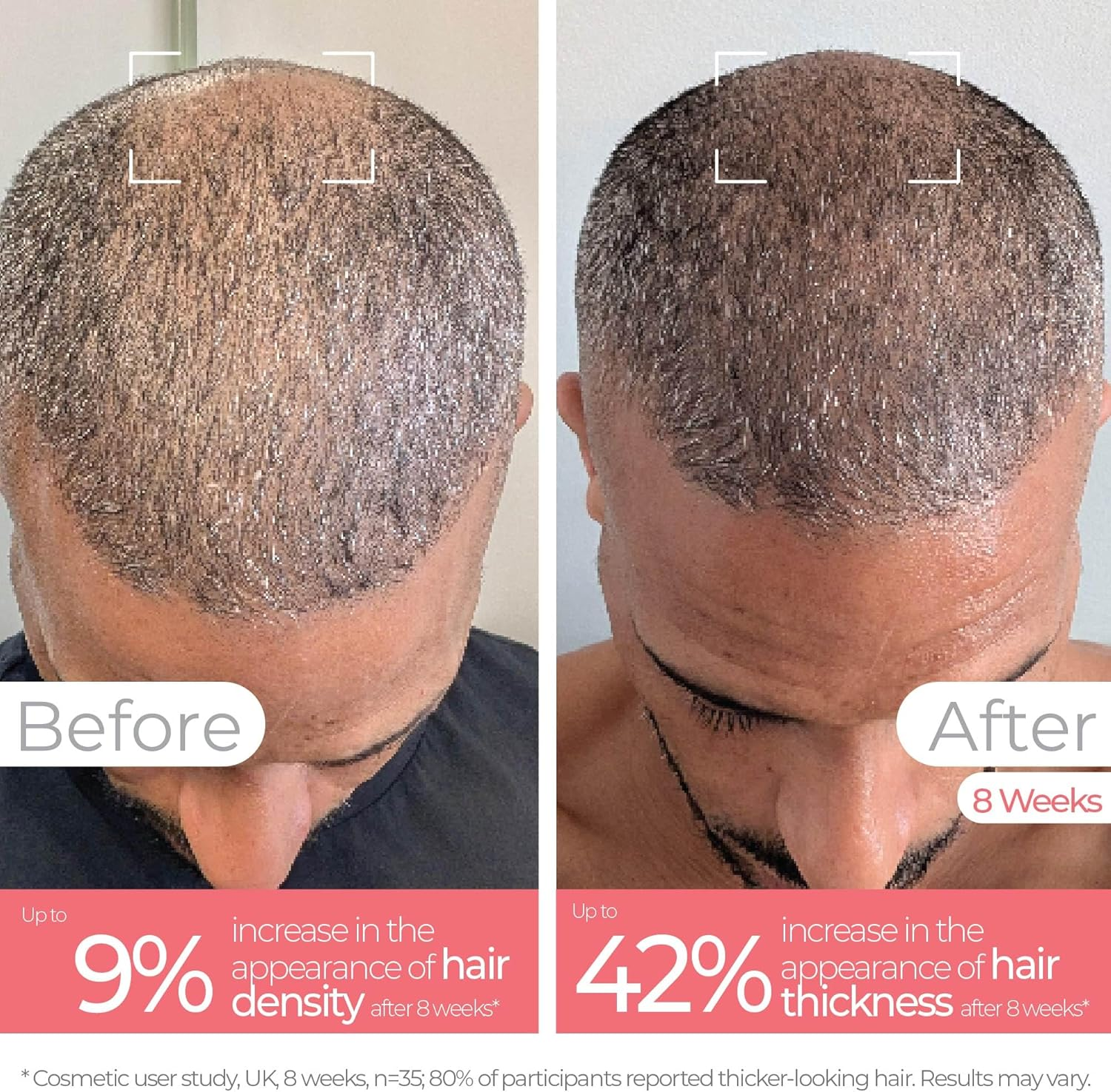 STYLPRO Red Light Hair Brush Comb, Encourages Hair Growth, Stimulates Hair Follicle, Aids in Hair Repair, 49X 655Nm Leds, Ergonomic Flexible Bristles, Rechargeable, Sonic Scalp Massage image number 1