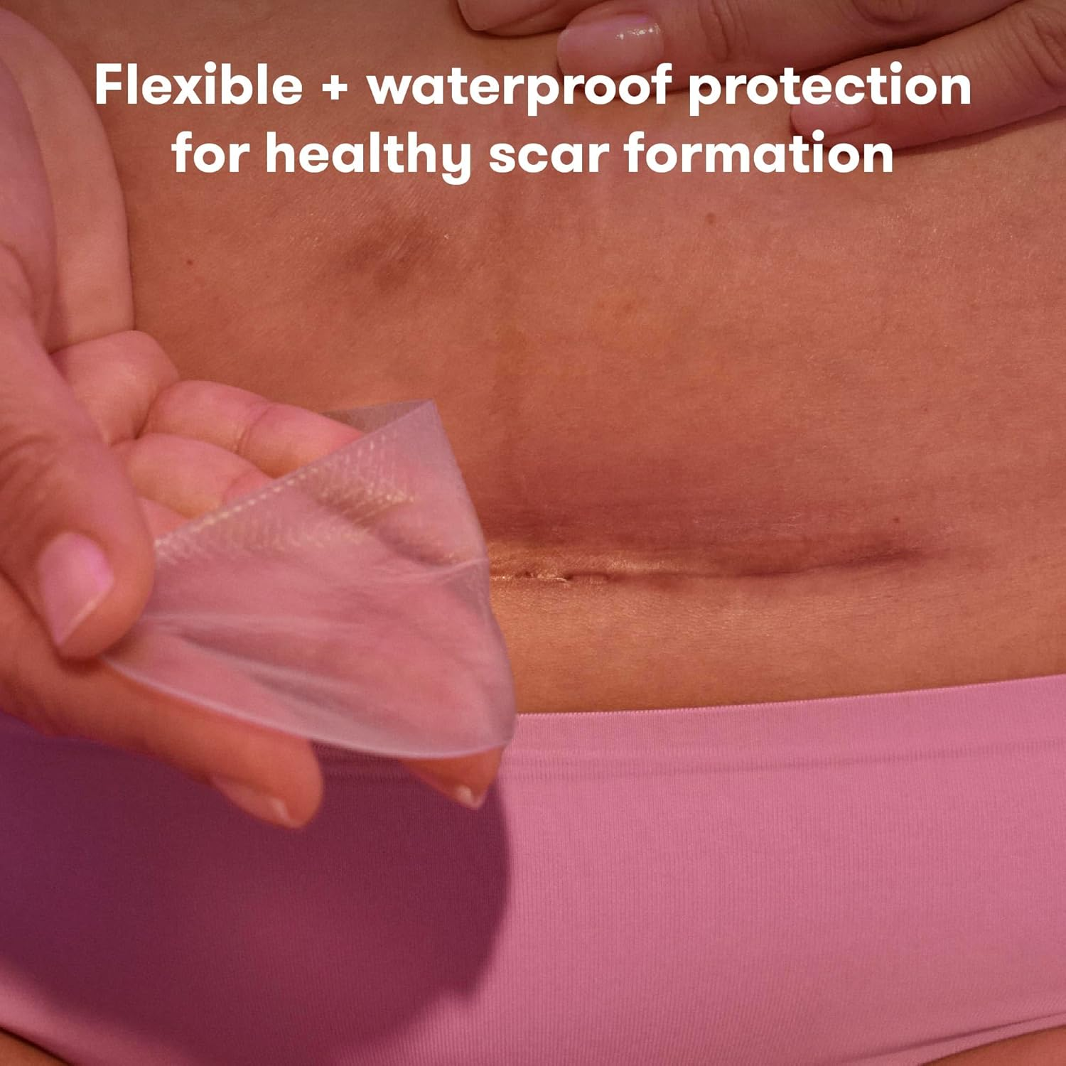 Frida Mom C-Section Silicone Scar Patches | Reusable Medical Grade Silicone Scar Treatment | Great for Keloid Scars | 6 8" Long Patches with Case and Pouch Included, Clear image number 2