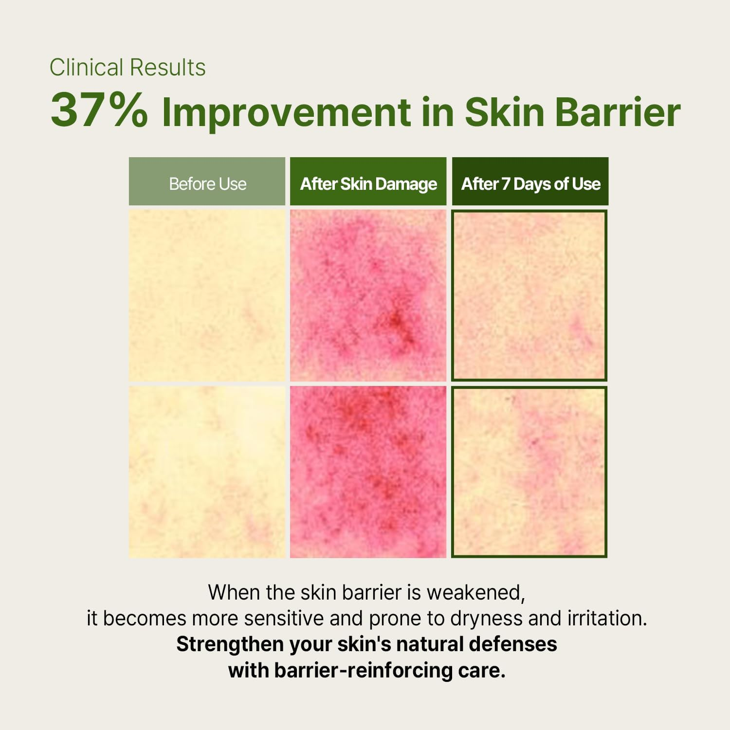 AVCA Cica Tea Tree Calming Serum 100Ml &ndash; Soothing for Redness & Sensitive, Blemish-Prone Skin, Oil Control K-Beauty image number 4