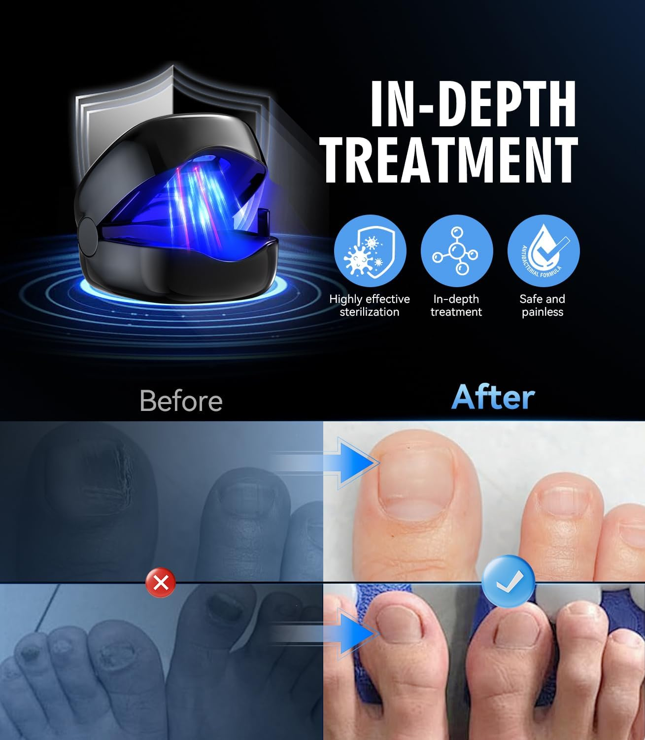 LOZLTX 8.0 Nail Fungs Laer Device 【Dualwave Tec - 99% Fungus Gone in 3Min】Nail Fungus Laser Device 【21-Day Fast-Acting】950Nm Infrared Light 500Nm Blue Light - Brown image number 6