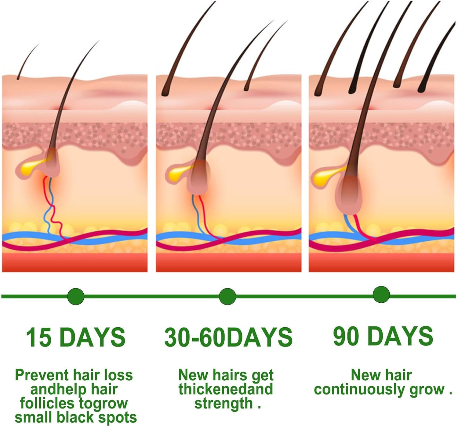 Rosemary Oil for Hair Growth, 30Ml Organic Rosemary Oil, Stimulates Hair Growth Rosemary Oil for Hair Loss, Natural Hair Strengthening Rosemary Oil, for Women & Men Hair Care image number 5