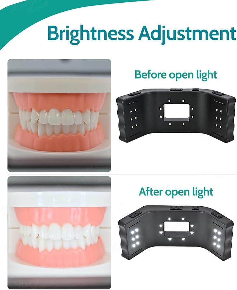 SUZLAZYR Mobile Dental Photography Light, Dentistry LED Oral Filling Light with 20 Lamp Beads, 6000-6500K Adjustable, Dental Photography Aid Kit for Home Salon image number 2