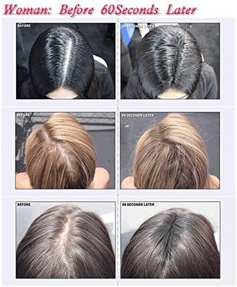 Hair Building Fibres 100% Natural Hair Loss Instant Treatment Thicker Concealer Balding 100G Refill Bag for Men and Women Dark Medium Light Brown Black (Light Brown) - Light Brown image number 4