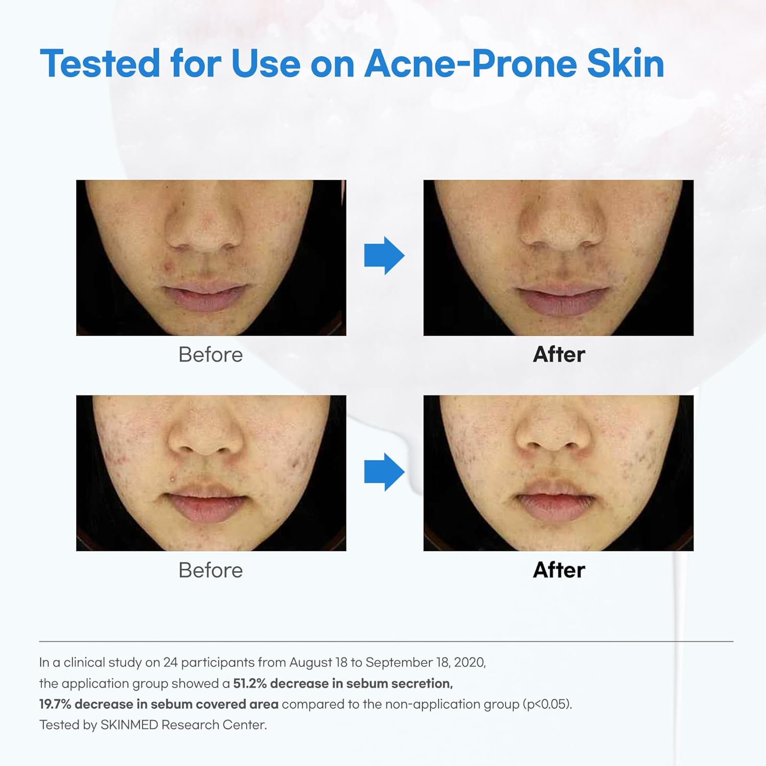 Luvum Witch Hazel Hyaluronic Toner Pad, Witch Hazel, Hyaluronic Acid, Ph 5.5, 60 Pads image number 6