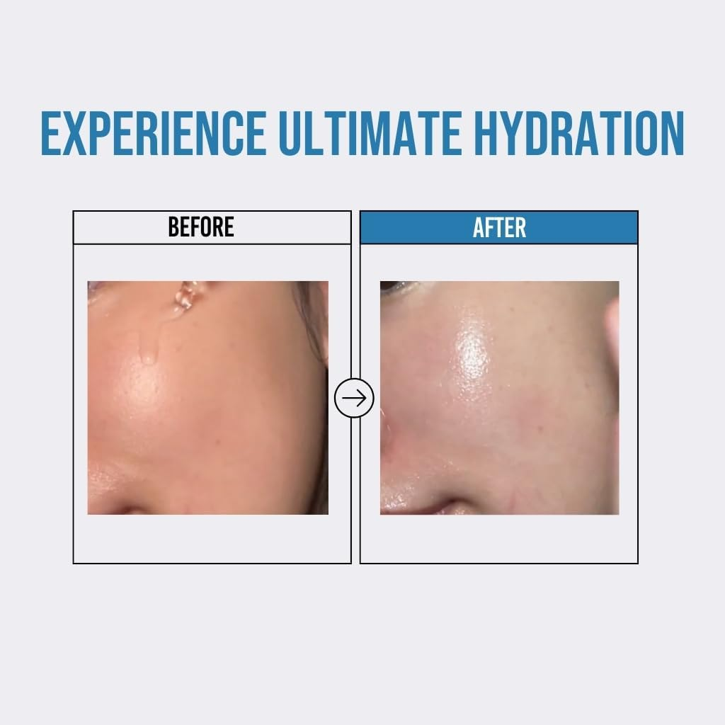 Helloskin Waterfull Hyaluronic Acid Serum 50 Ml image number 2