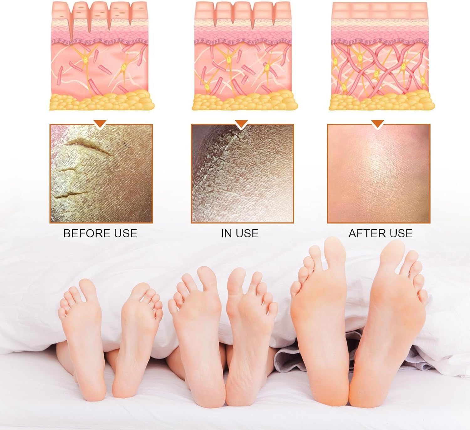 Foot Peeling Spray, Removal Dead Skin, Moisturized and Brighten Skin,Exfoliating Peeling Calluses on Feet, Smoothing Dry & Cracked Feet, Multi - Use for Hands & Joints,Knee,Ankle,Elbow (1PCS) - 4Pcs image number 6