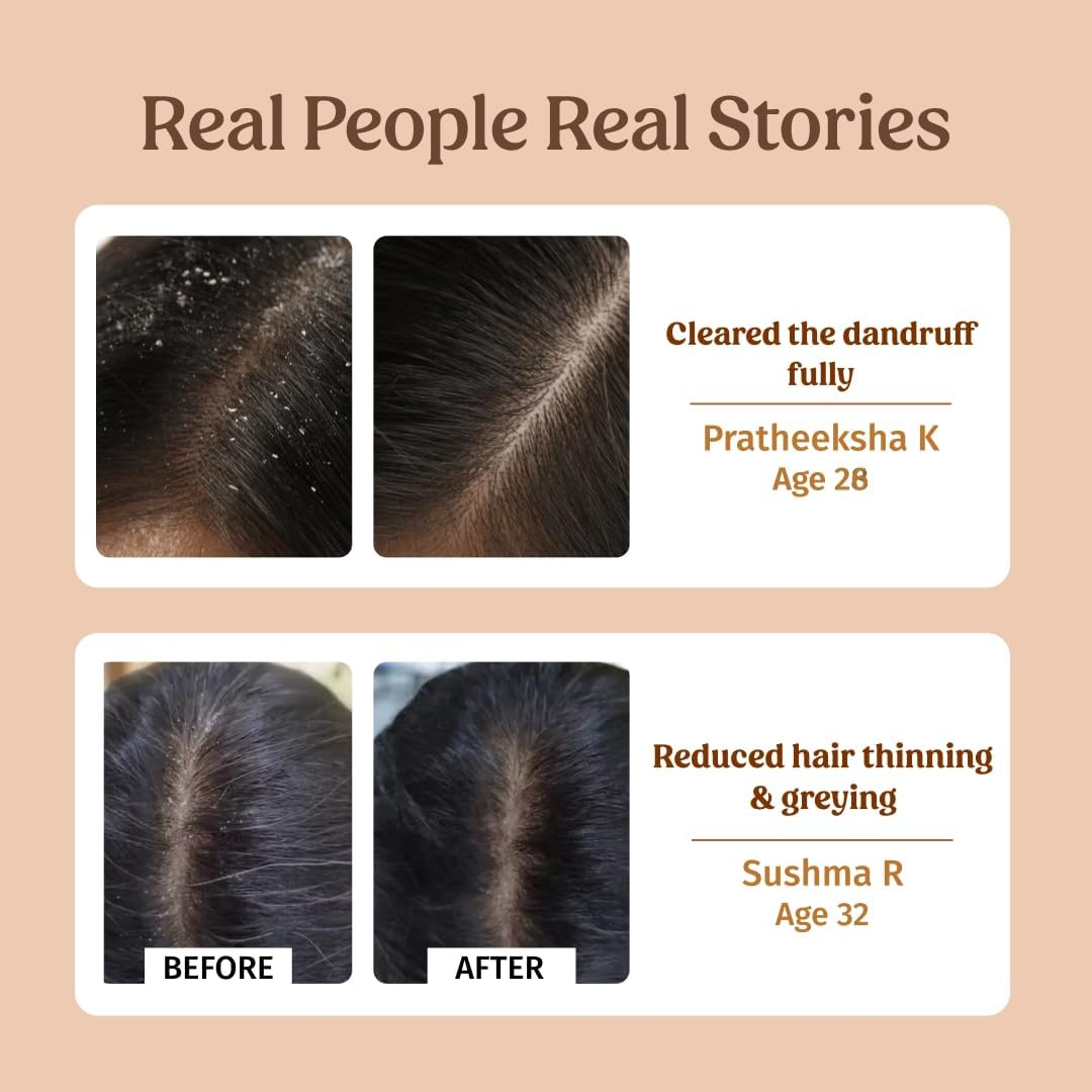 Vilvah Store Herbal Shampoo for Dandruff Control, anti Dandruff Shampoo, Relieves from Dandruff Related Itching, Soothes Scalp & Nourishes Hair, SLS & Paraben Free, for Men and Women, 250Ml image number 1