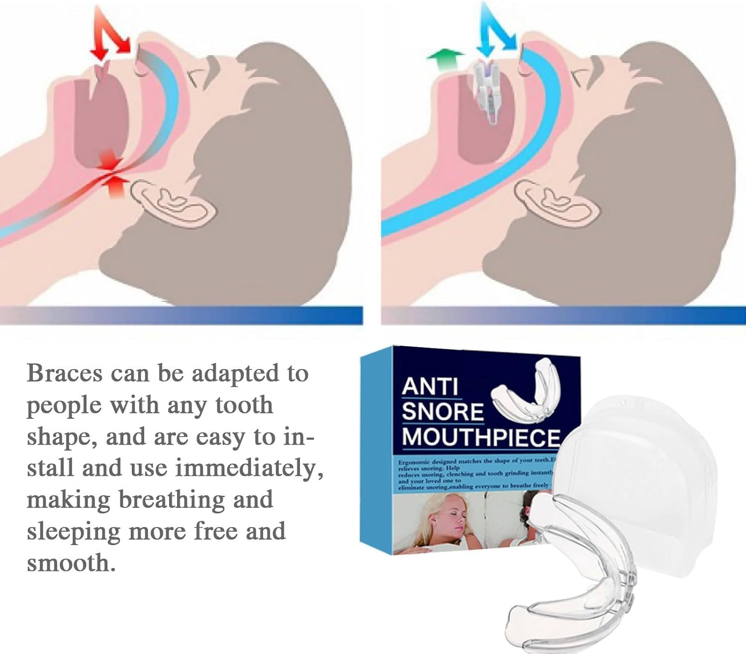 Adjustable anti - Snoring Mouth Guard for Men Women Comfortable All Types Device Mouthpiece to Stop Prevent Oral Appliance Reduce Men&rsquo;S Women&rsquo;S Solution Product Protection against Aid image number 5