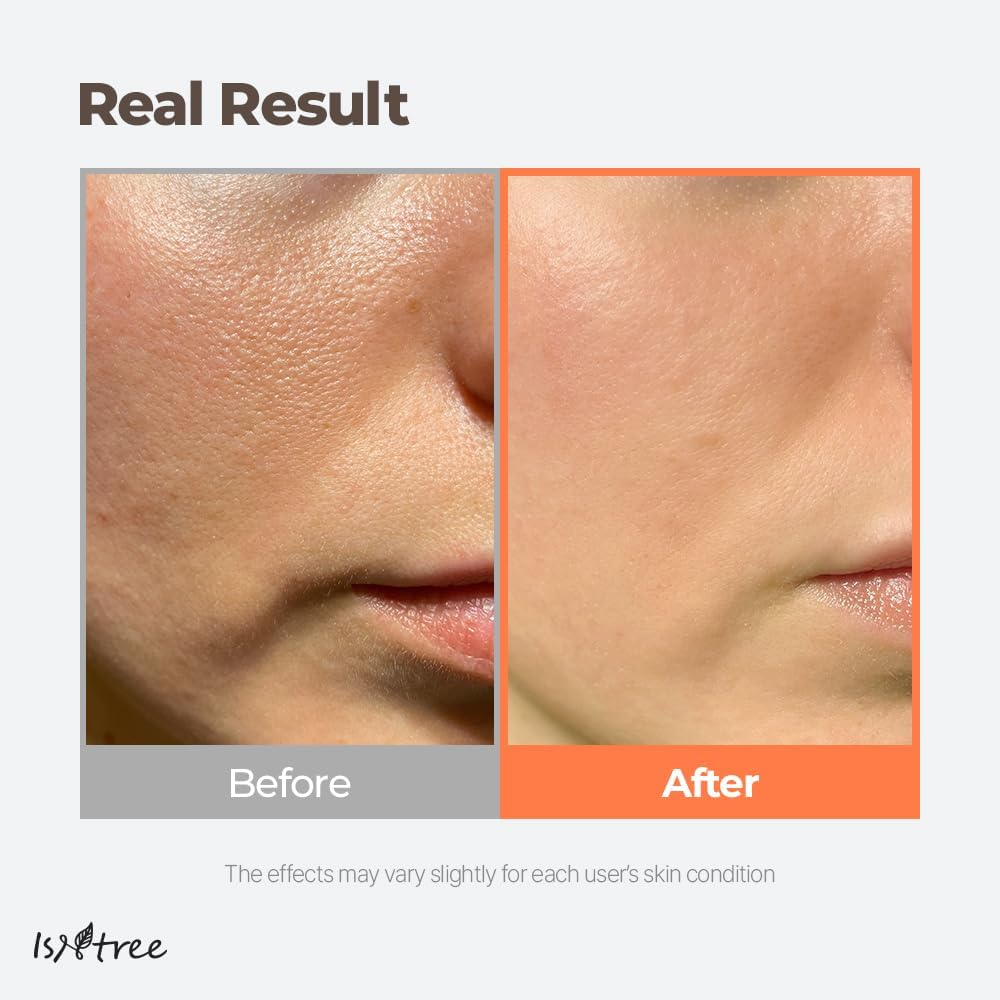 ISNTREE Green Tea Fresh Facial Toner 200Ml, 6.76 Fl. Oz. with Hyaluronic Toner 50Ml | Deep Moisturizing.