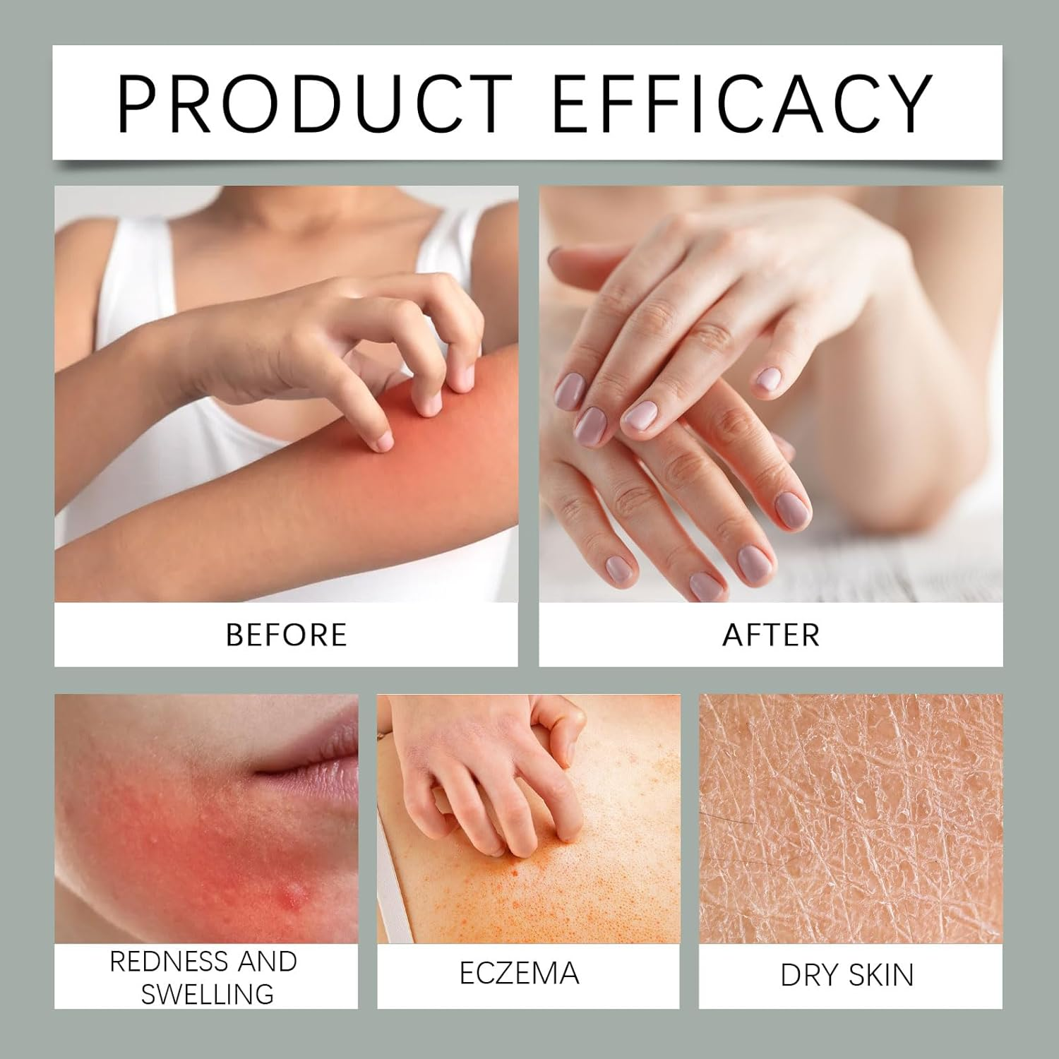 Wild Yam Cream Hormone Balance, Skin Hydrating & Nourishing Moisturiser for All Skin Types, Firm and Nourish the Skin, Estrogen Support Balm, Alleviate Menopause-Related Issues (4PCS) image number 4