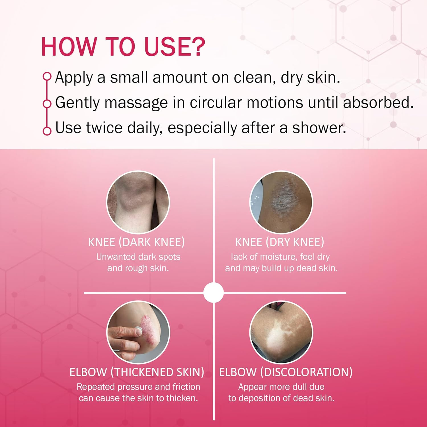 7 DAYS Elbow & Knee Whitening Cream for Men & Women(100 Gm)