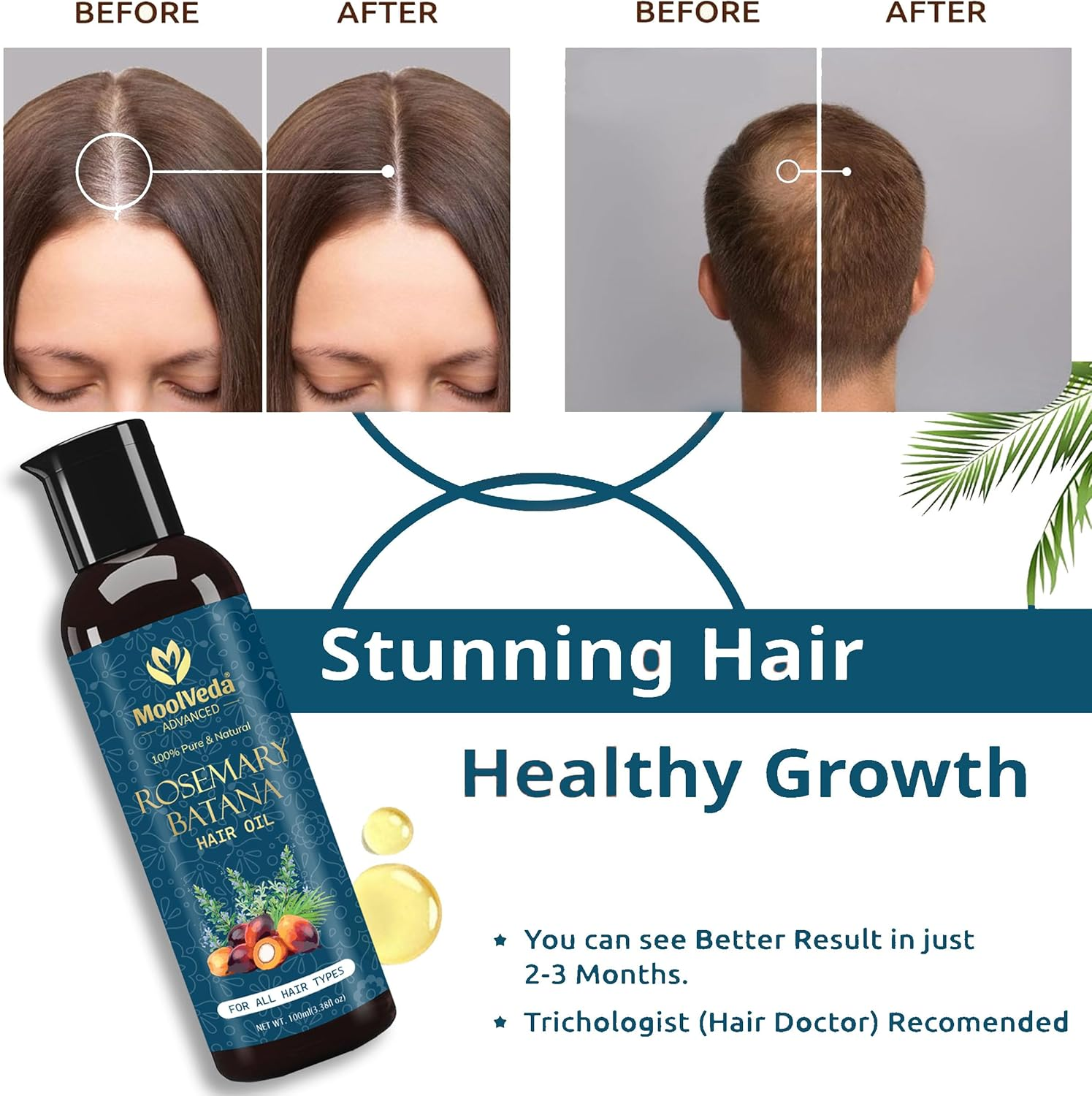 Rosemary Batana Oil 3.38 Fl Oz (Pack of 1) image number 5