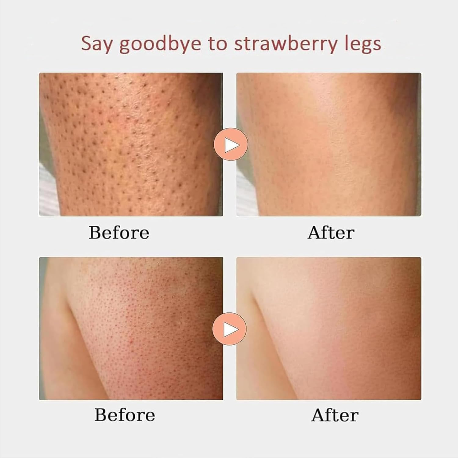 Strawberry Skin Resurfacing Cream, Strawberry S/Kin Treatment, Legs Treatment Body Cream, Anti-Wrinkle Moisturizing Lotion,Smooth Arm and Leg, Reduce Chicken Skin Bumps and Uneven Textures (2PCS)