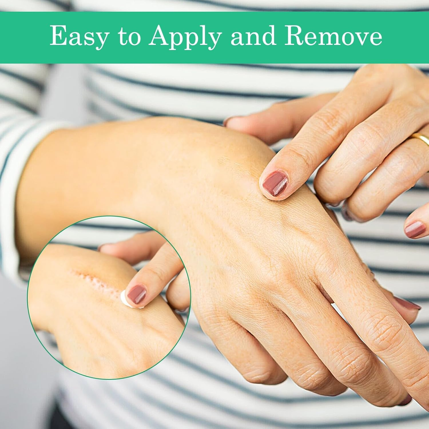 Silicone Scar Tape, 2 Pcs Silicone Scar Sheets, Soft Silicone Tape, Hydrocolloid Bandages for C-Section, Surgery, Burn, Keloid, Acne Et, Easy Tear Reusable Scar Removal Sheet (1.6 &times; 60 Inch) image number 4