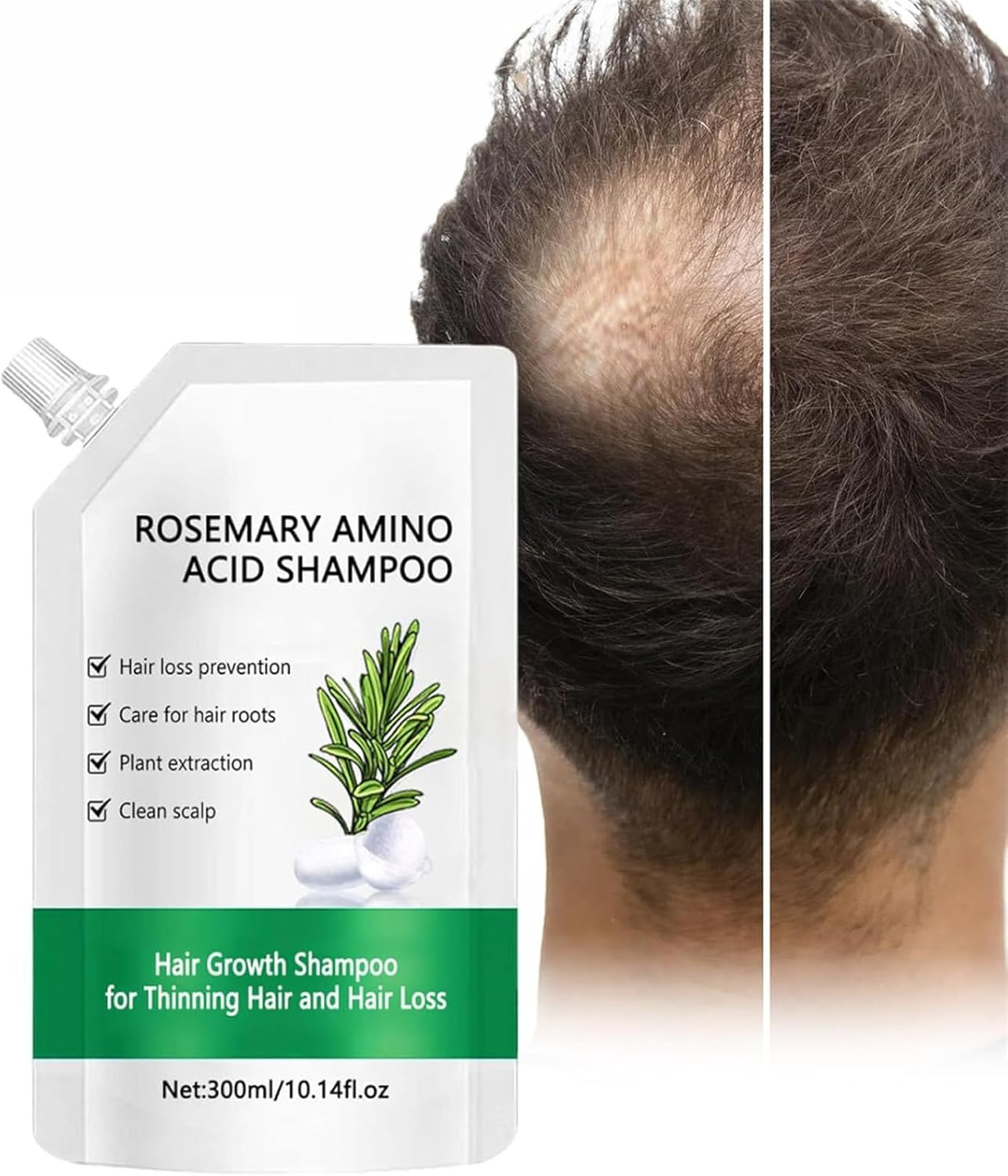 Rosemary Amino Acid Shampoo, Hair Growth Shampoo, Thickening & Strengthening Shampoo with Hydrolyzed Keratin, for Thinning Hairs Women and Men Hair Loss and Oily Scalp (1Pc) - 1Pc image number 3