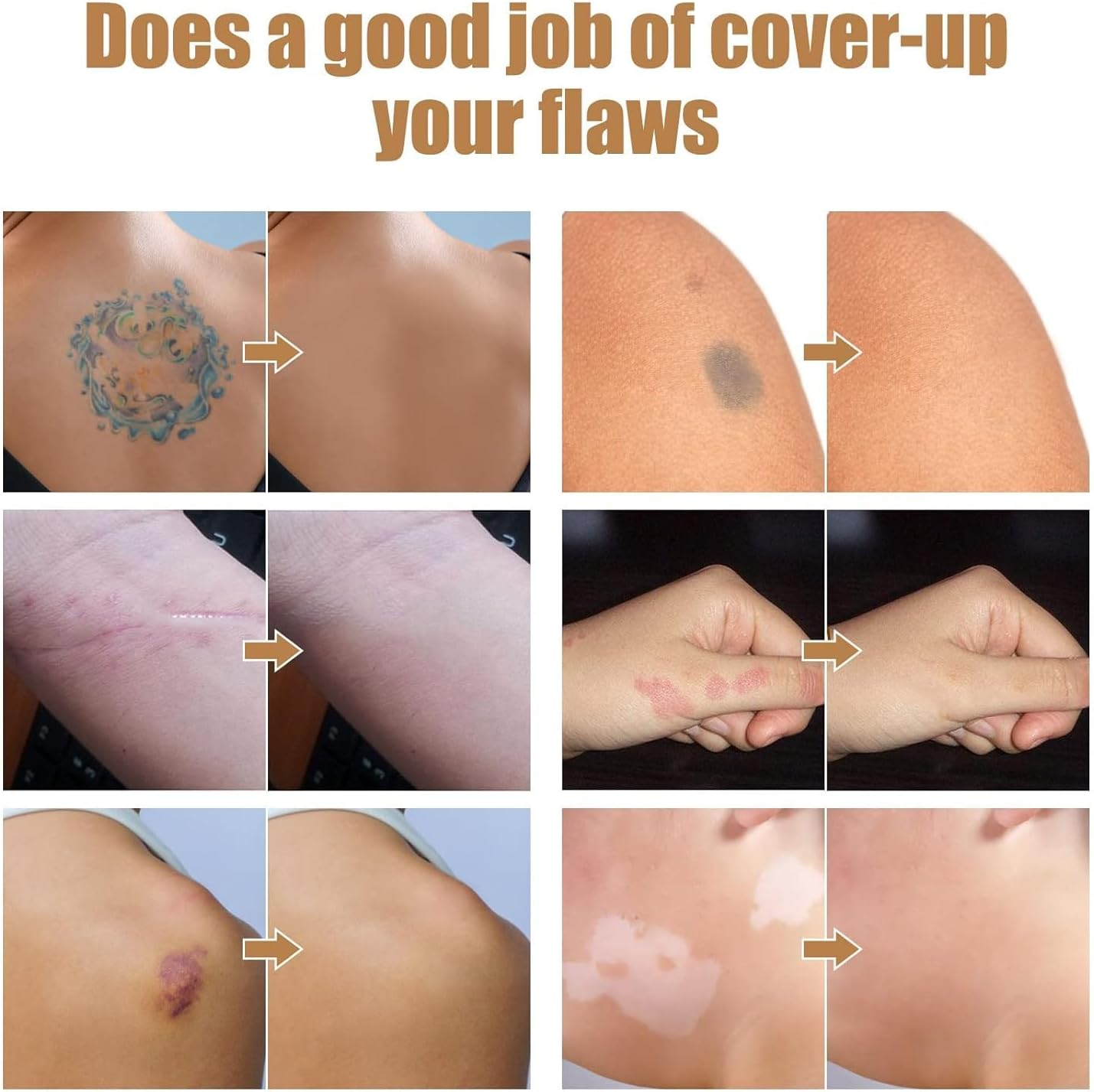 Tattoo Concealer, 2 Colors Tattoo Cover up Makeup Waterproof Sweatproof, Invisible Skin Concealer Set, Long Lasting Suitable for Tattoo, Dark Spots, Scars, Vitiligo image number 2