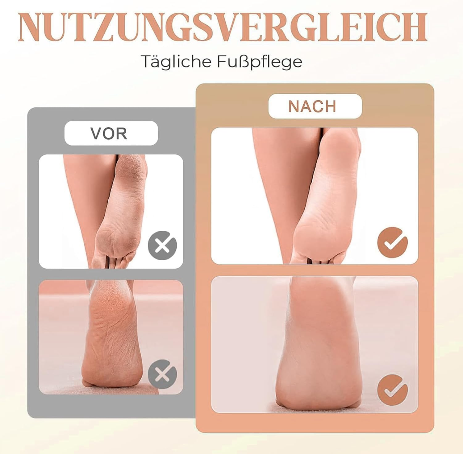 Electric Callus Remover | Foot Callus Remover Tool Electric,Rechargeable Electronic Grinder Scrubber Pedicure Tools for Women Men Rough Skin Cracked Heel image number 4