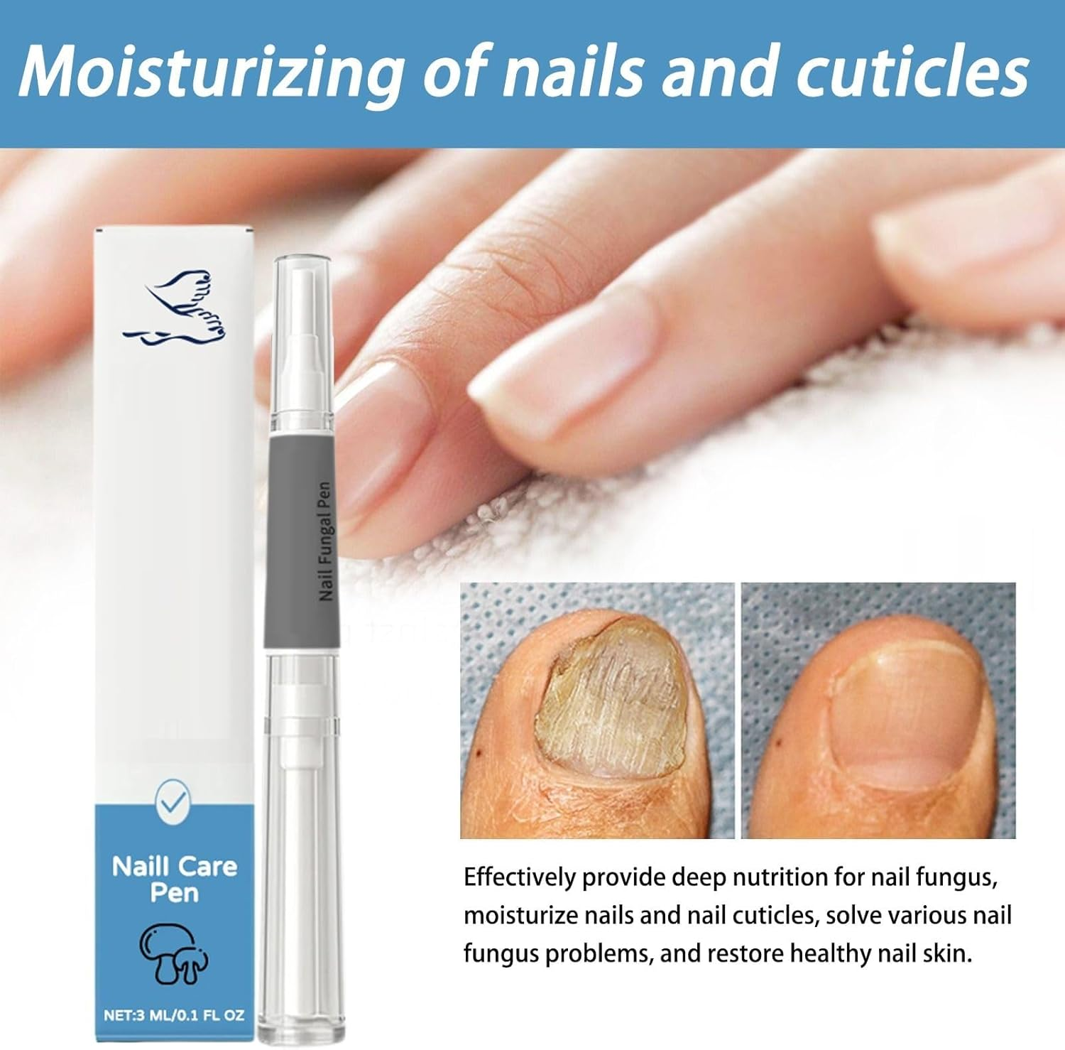 Antifungal Nail Pen for Toenails and Fingernails, Extra Strength Fungus Treatment & Repair Serum with Natural Ingredients, Nail Strengthener and Growth Support (2 PCS) image number 6