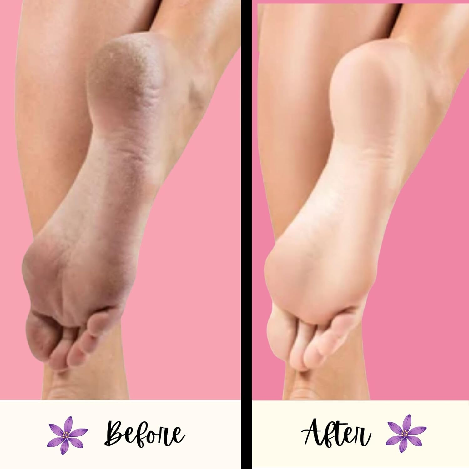 Mr. Pumice Mr. Pumice Purple Pumi Bar, Extra-Coarse Callus Remover, Pedicure Stone & Ped File Scrubber for Smooth Feet and Heels, 6 Count image number 1