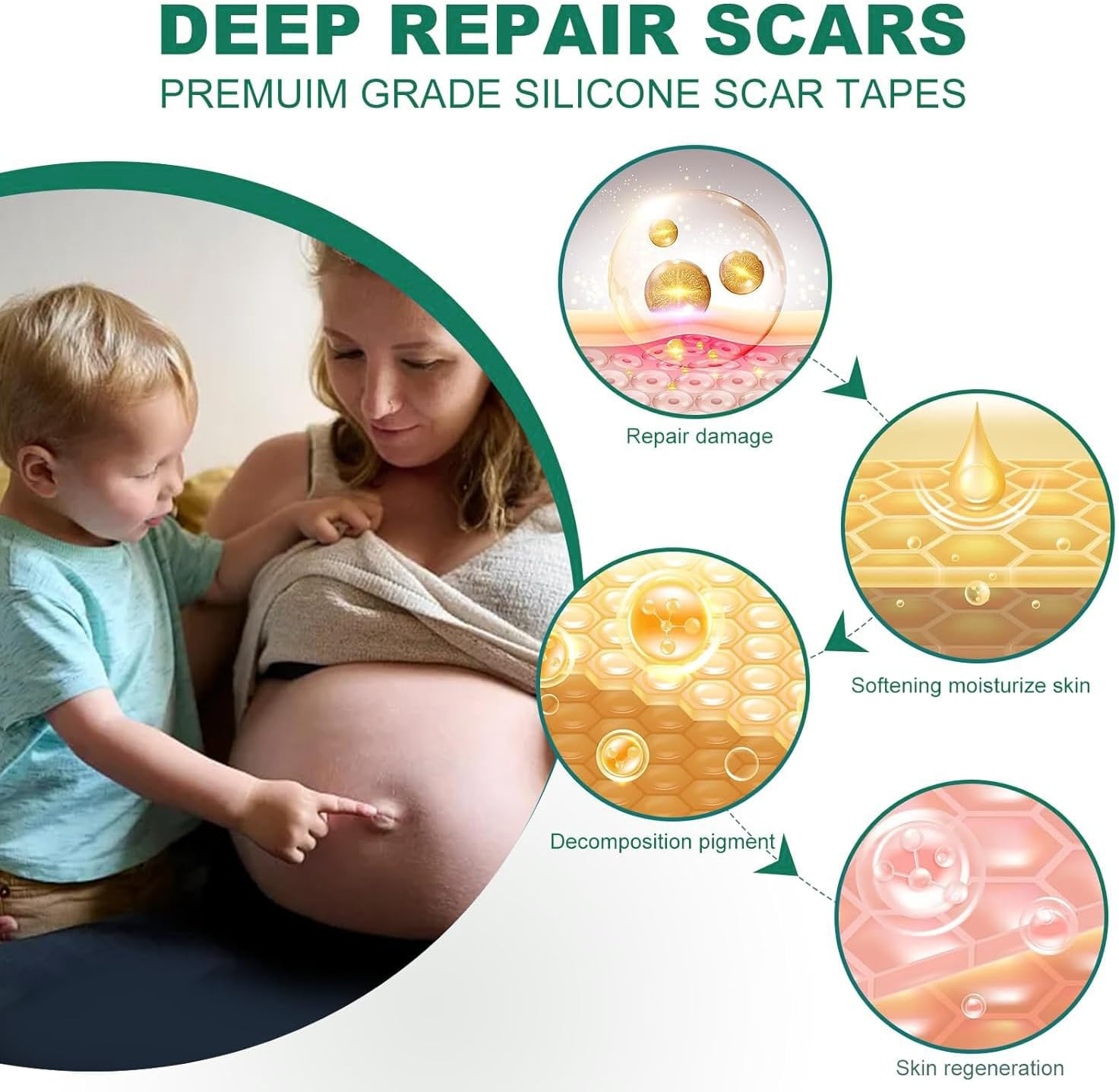 Silicone Scar Sheets & Tape for Surgical Scars, C-Section, Tummy Tuck | Scar Removal Strips to Repair, Fade & Remove Keloid Bumps | 1.5M Roll (4X150Cm) | Hypoallergenic, Reusable Medical Grade image number 4