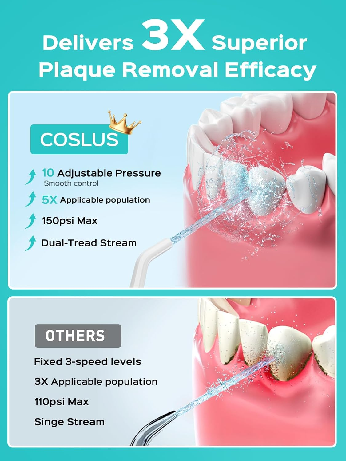 COSLUS Cordless Water Flosser for Teeth: 10 Pressure Settings Water Dental Pick for Orthodontic, Braces, Sensitive Gums, 5 Tips for Multiple Users, Rechargeable for Travel, Bpa-Free, White, E40(WFP14)