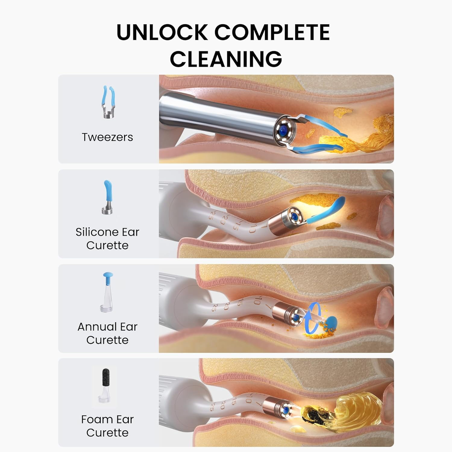 Bebird Earwax Remover, Earsight plus Otoscope,Flexible Ear Scope Otoscope Camera Light 1920P Hd,Ear Cleaner with Portable Case for Adults,Kids,Ios,Android（White） image number 4