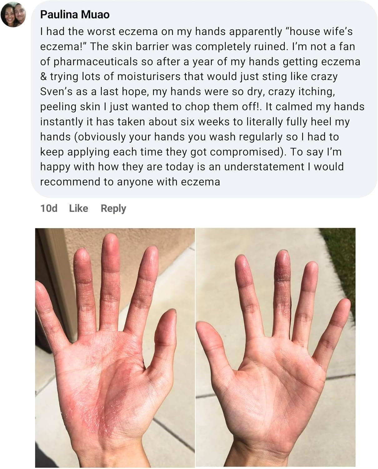 Miracle Manuka ? Natural Skin Balm (55G) | Botanical Blend for Everyday Skin Care | Gentle, Steroid-Free & Suitable for All Ages | Made in New Zealand image number 1