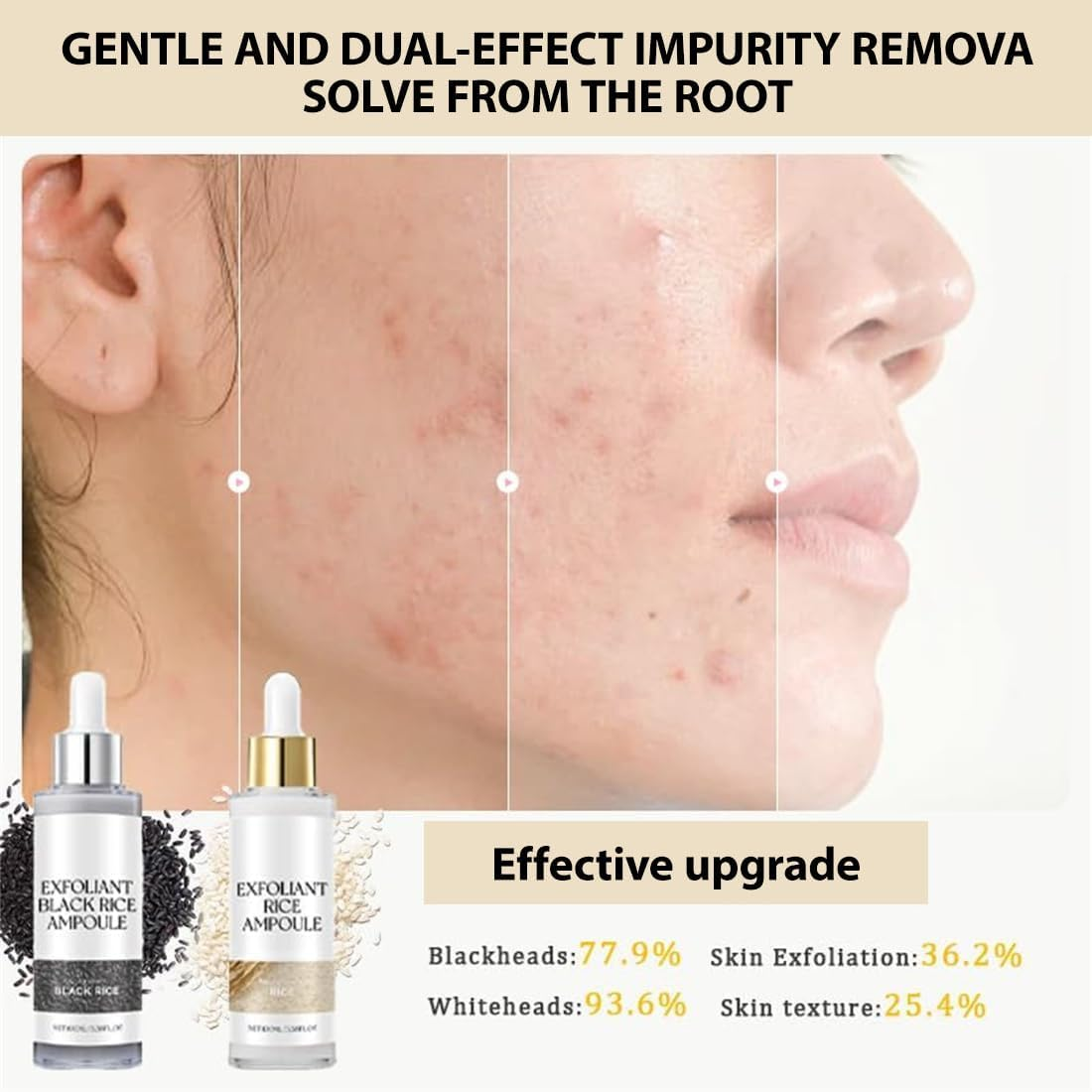 2PCS Exfoliating Ampoule, Black and White Rice Peeling Ampoule for Face & Body,Deeply Hydrates,Smooths & Refines Skin Texture (Black+White) image number 6