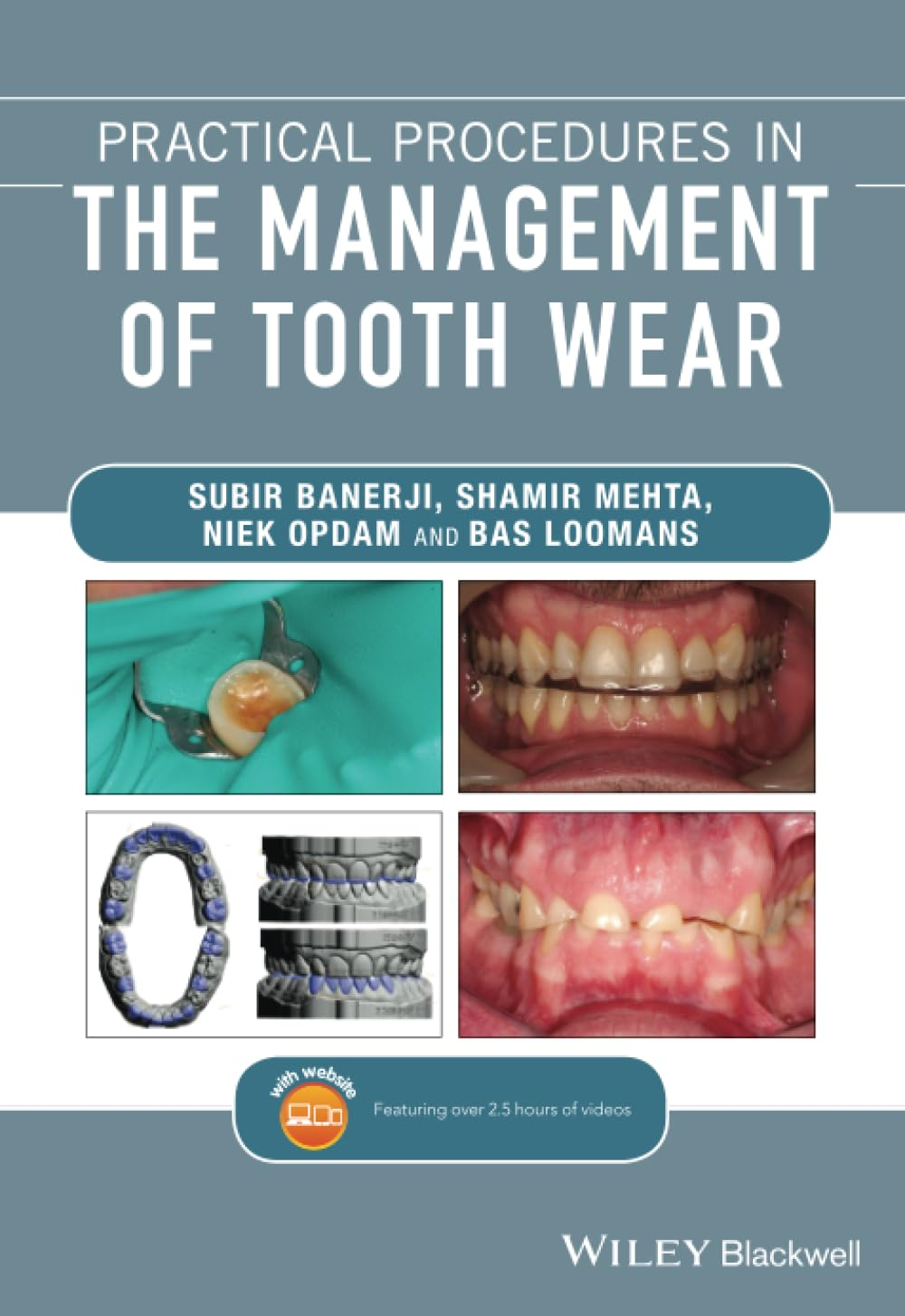 Practical Procedures in the Management of Tooth Wear image number 1