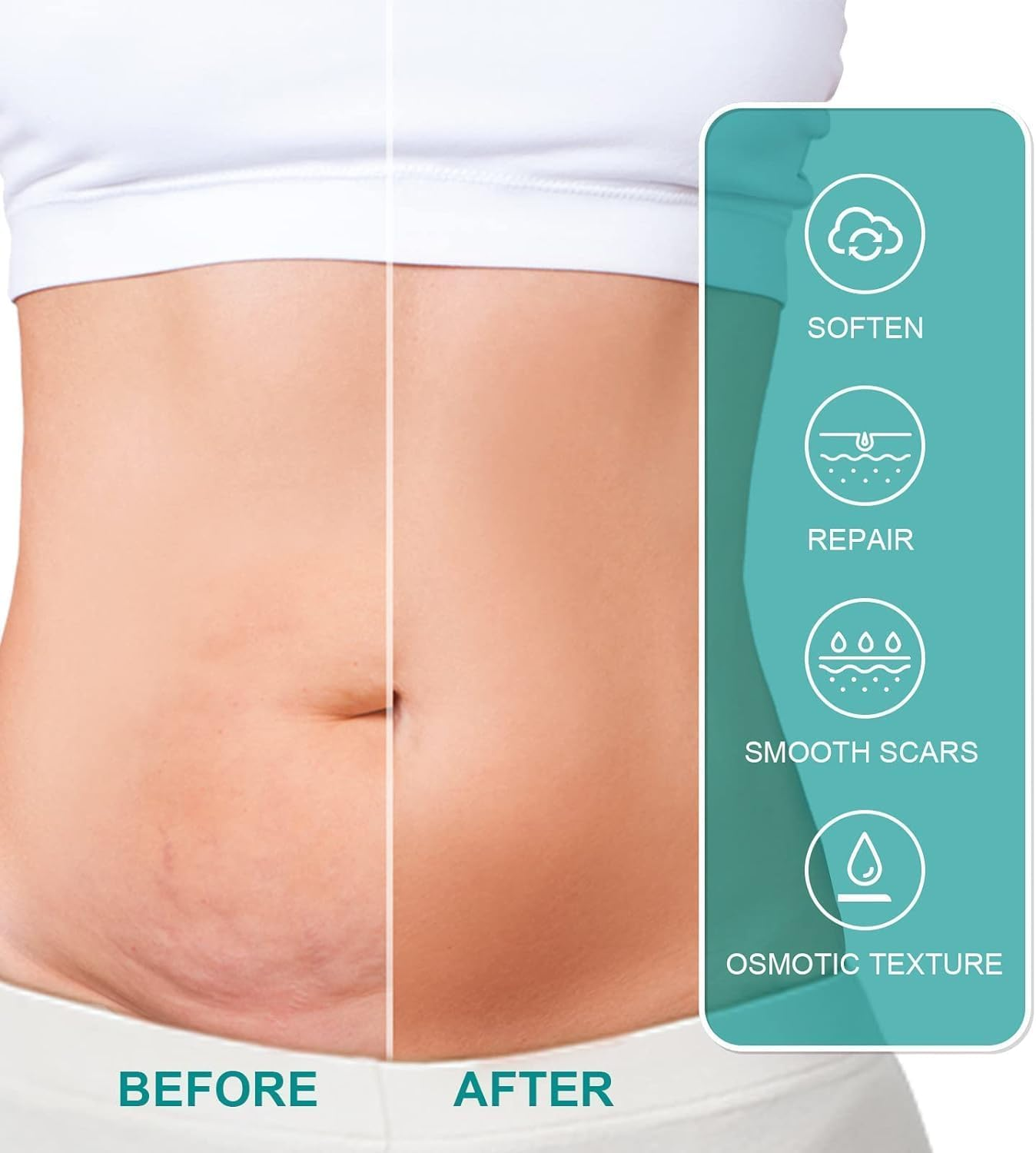 Healing Scar Care Spray, Advanced Formula for All Types of Scars, Acne Scar Treatment, Medical Grade Scar Spray, Facial Acne Scar Treatment image number 5