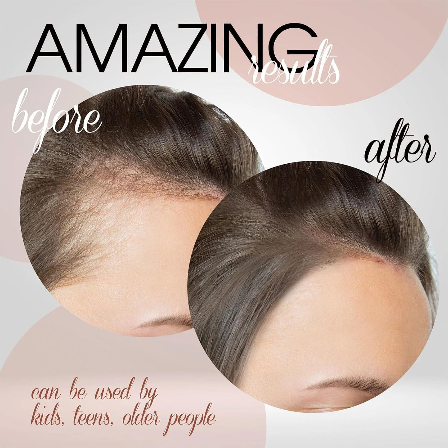 LYSYYAZ Deoxyribose Gel Hair Growth Serum, 60Ml, Unisex-Adults, Clear, Gel Form, for Hair Loss & Thinning, 1 Pcs