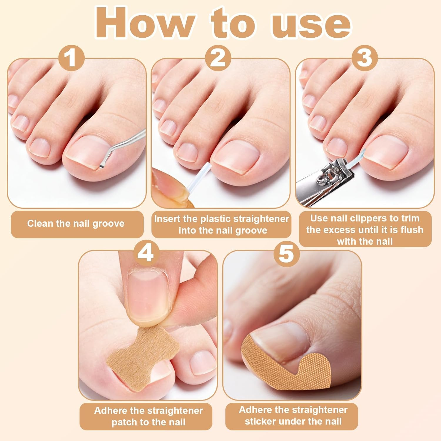 Ingrown Toenail Tool Set, Feet Pedicure Tools with Nail File & Clippers Skin Bevel Knife Toenail Groove Pick & Spoon Nail Stickers for Men Women Pedicure Tool image number 3