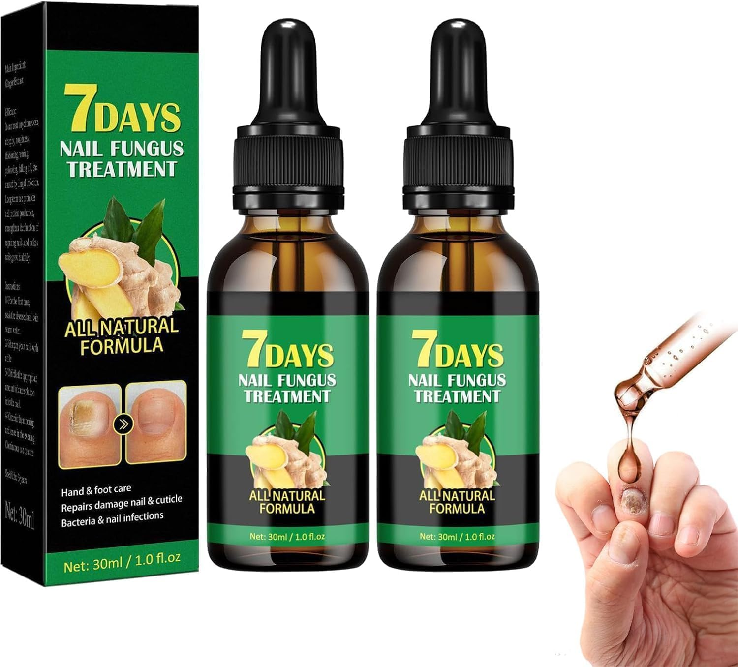 Ginger Nail Support Nail Care,Nail Strengthener for Damaged Nails,7 Days Nail Fungus Treatment,Toenail Cuticle Care Oil for Nails